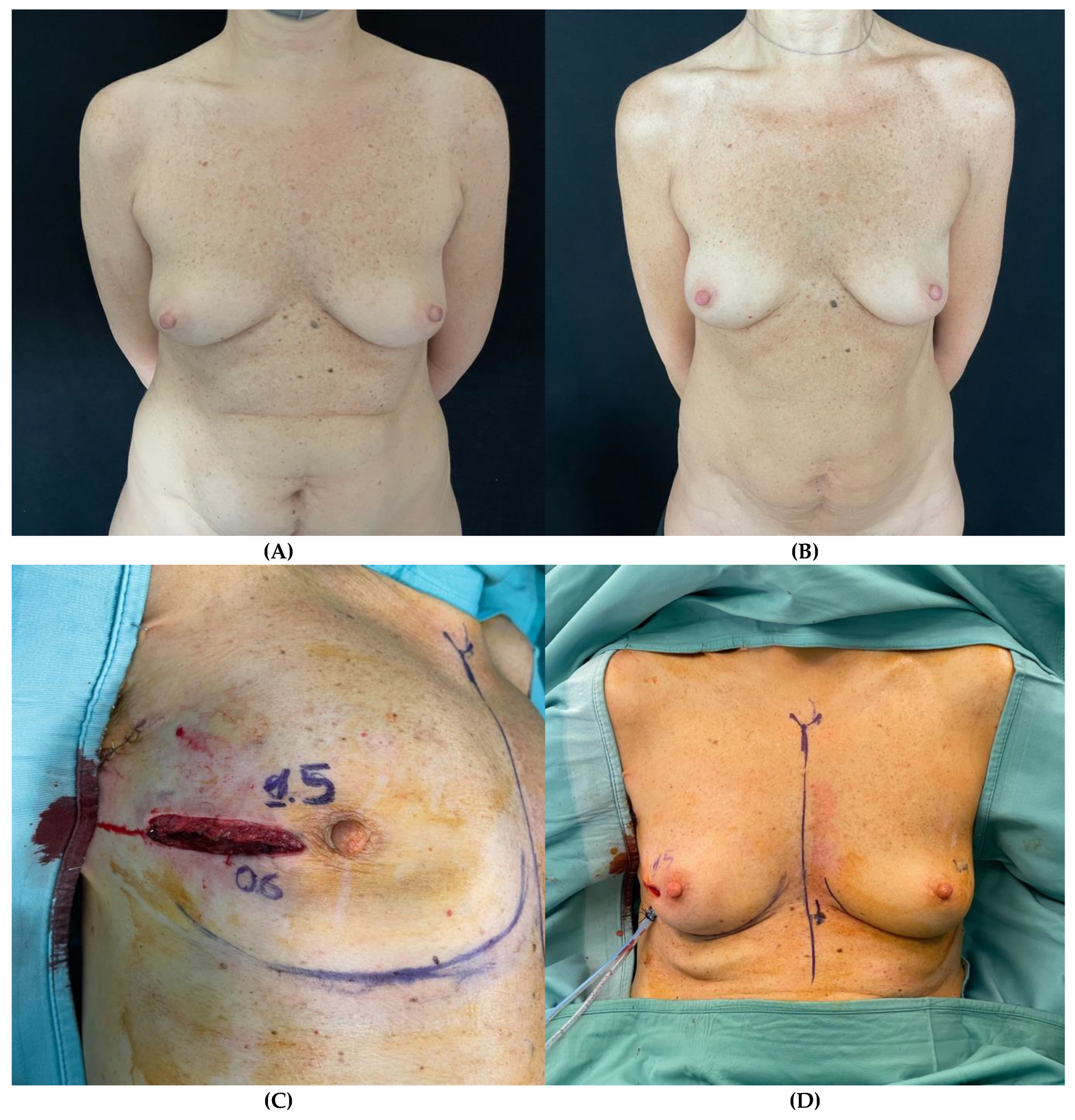 Preprints 141758 g002