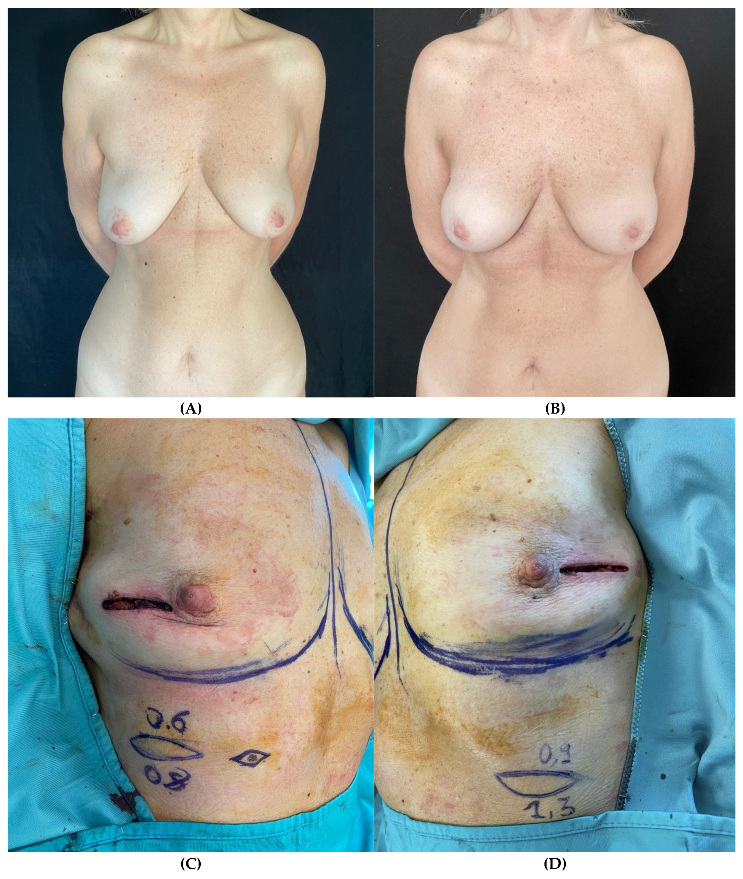 Preprints 141758 g003a