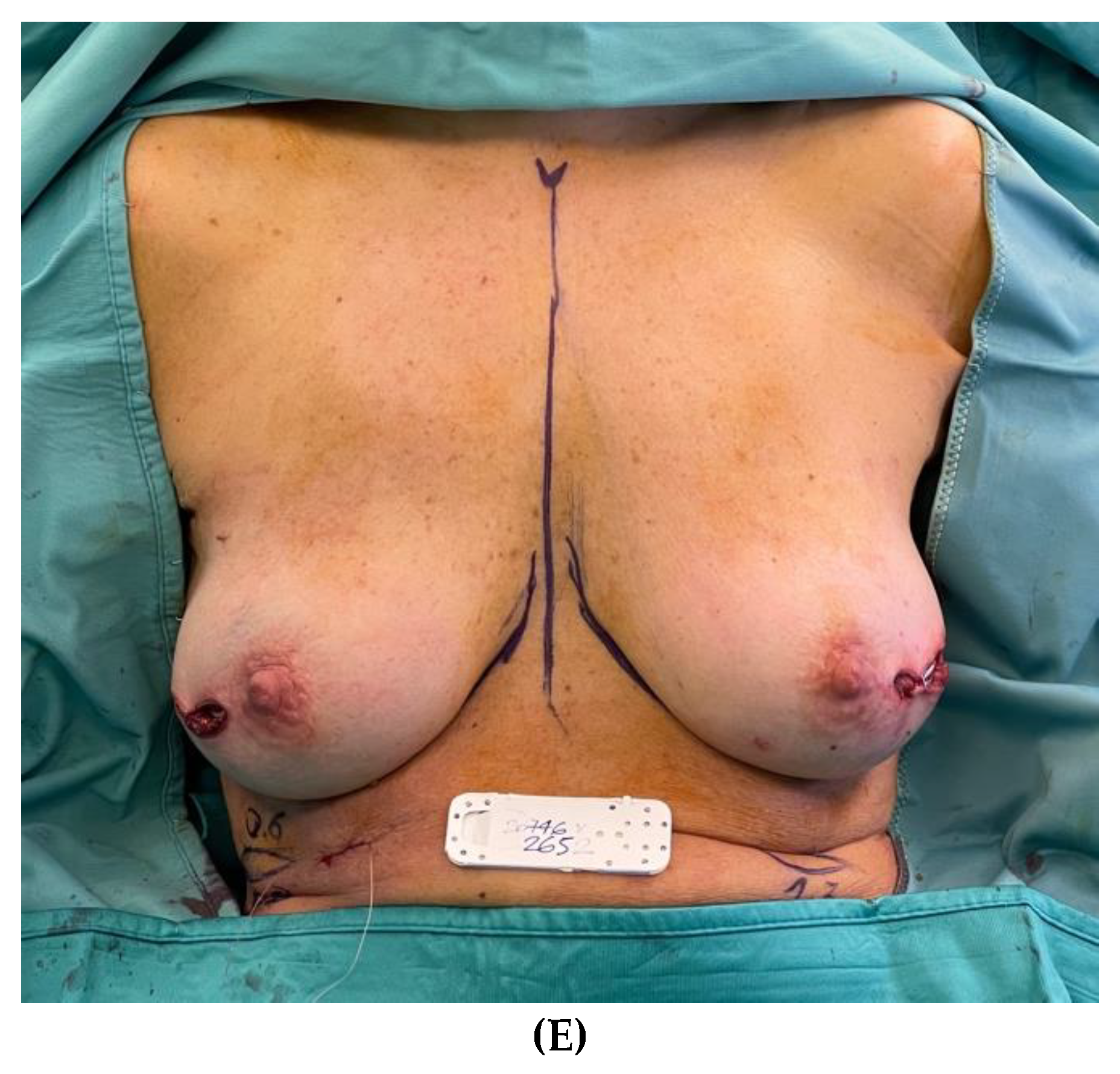 Preprints 141758 g003b