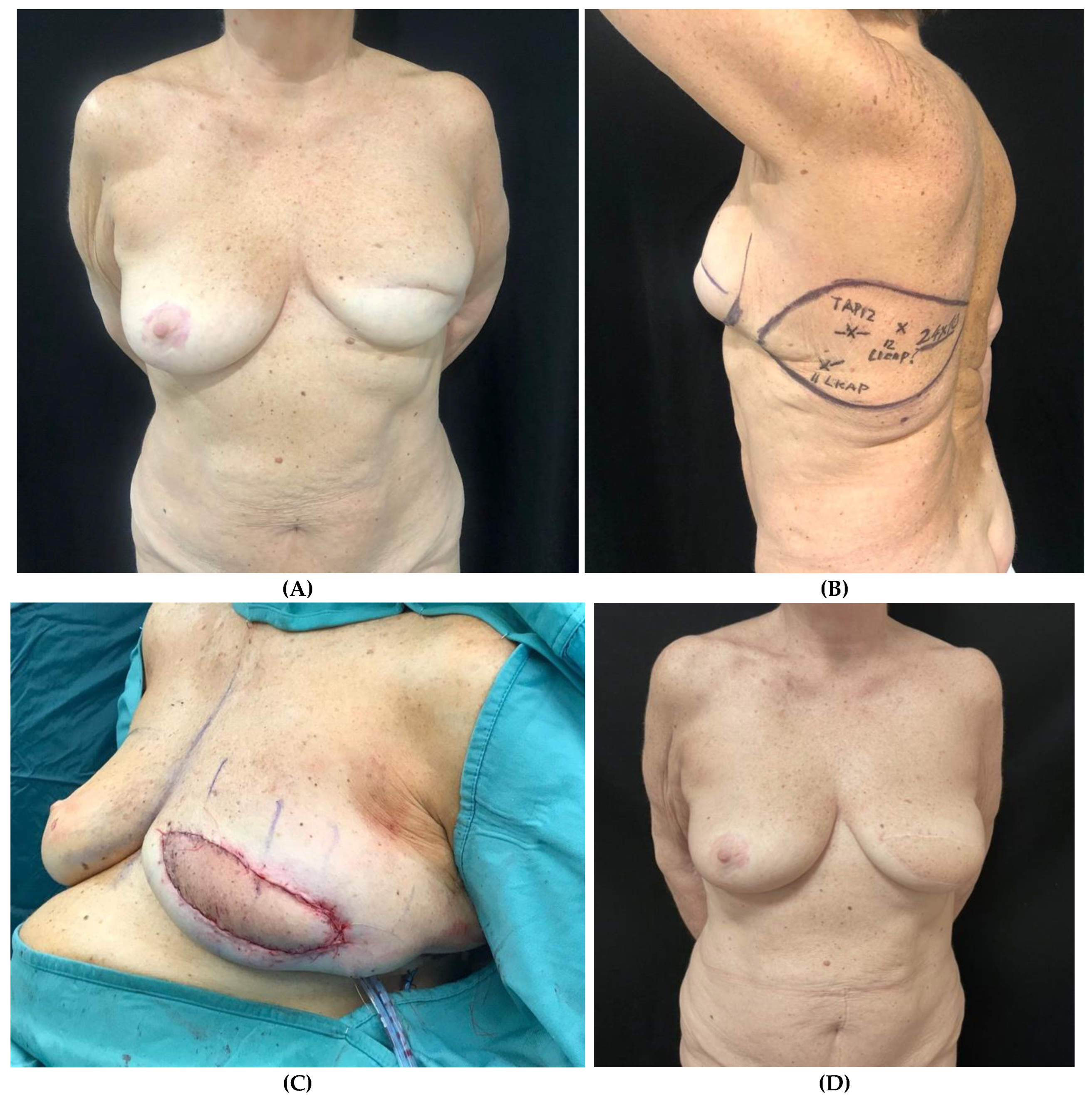 Preprints 141758 g004