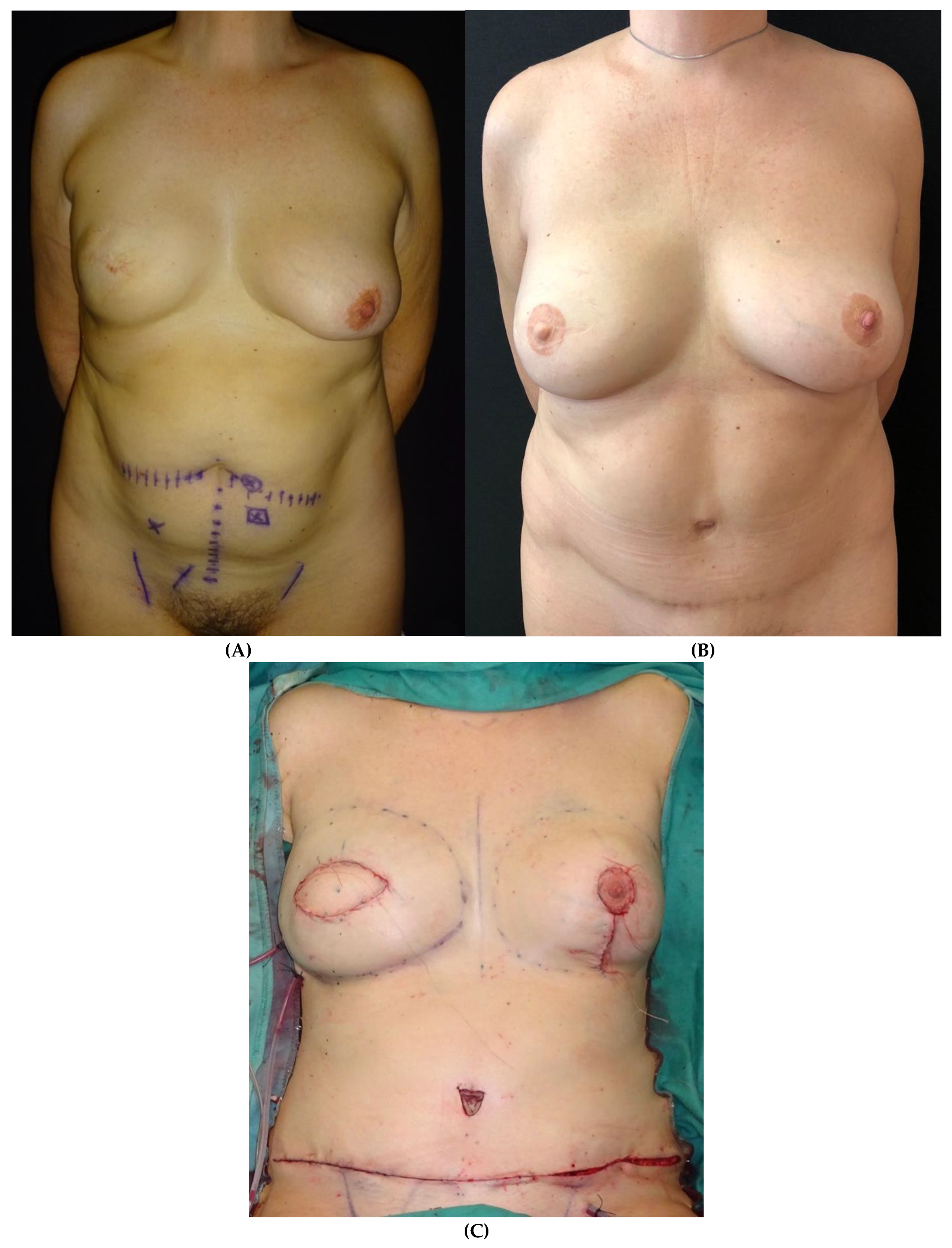 Preprints 141758 g005