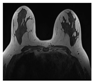 Preprints 196154 i001