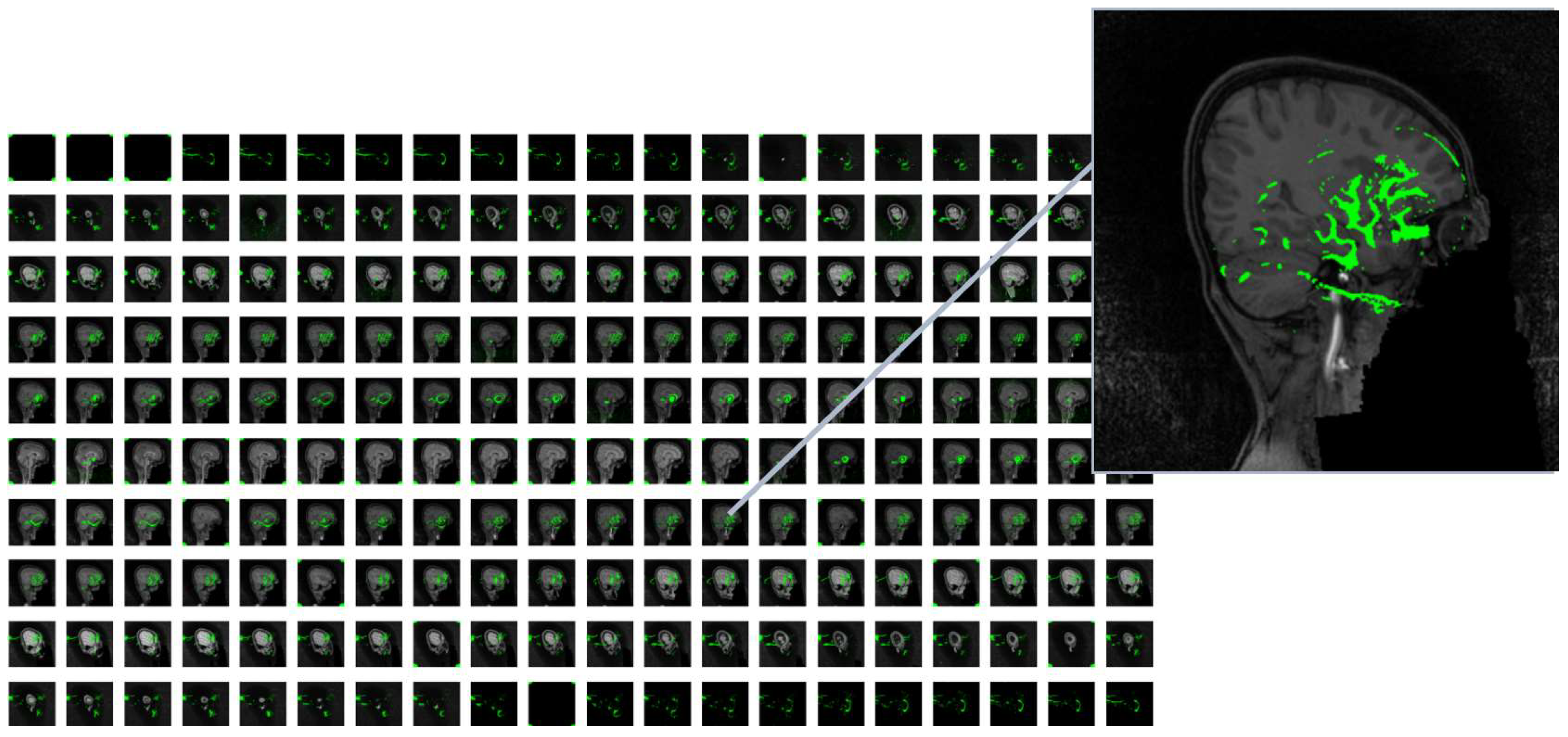 Preprints 148585 g005