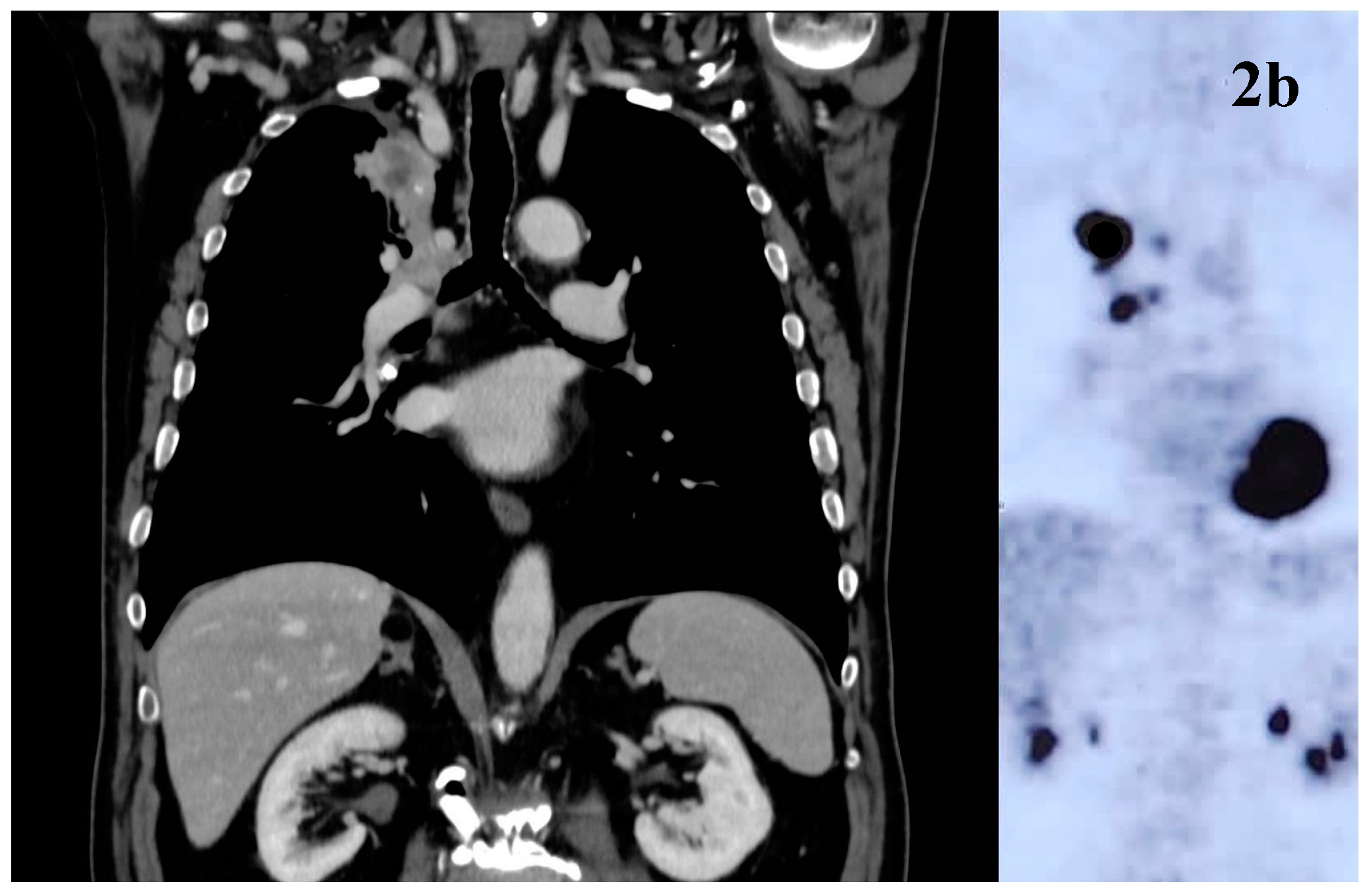 Preprints 139238 g002