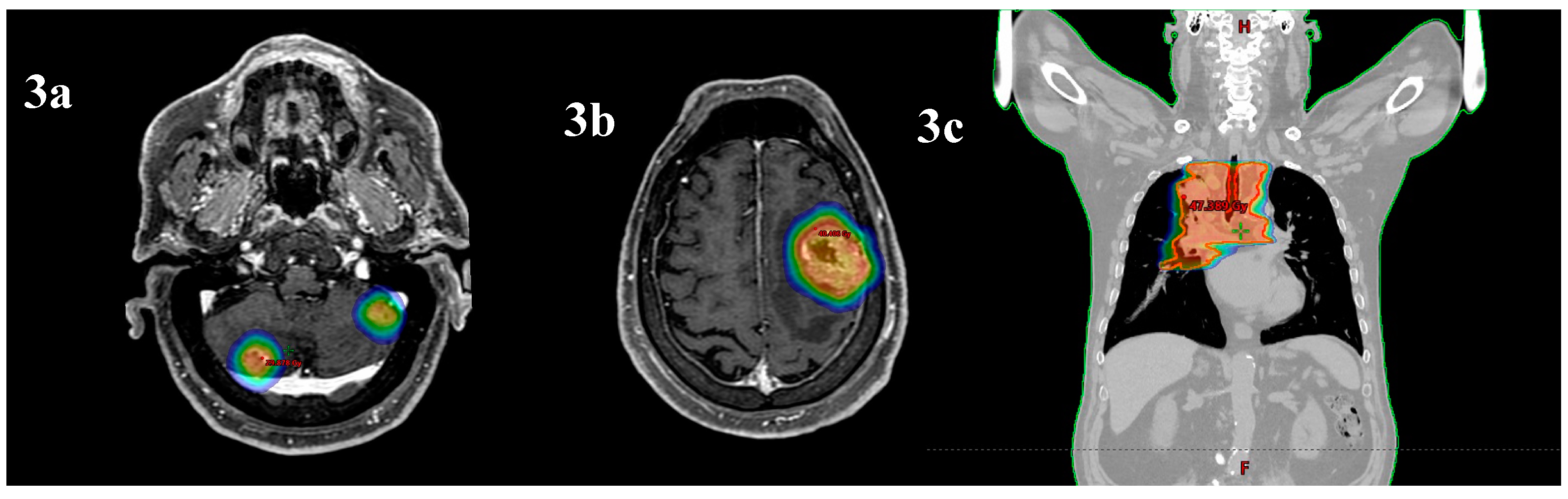 Preprints 139238 g003