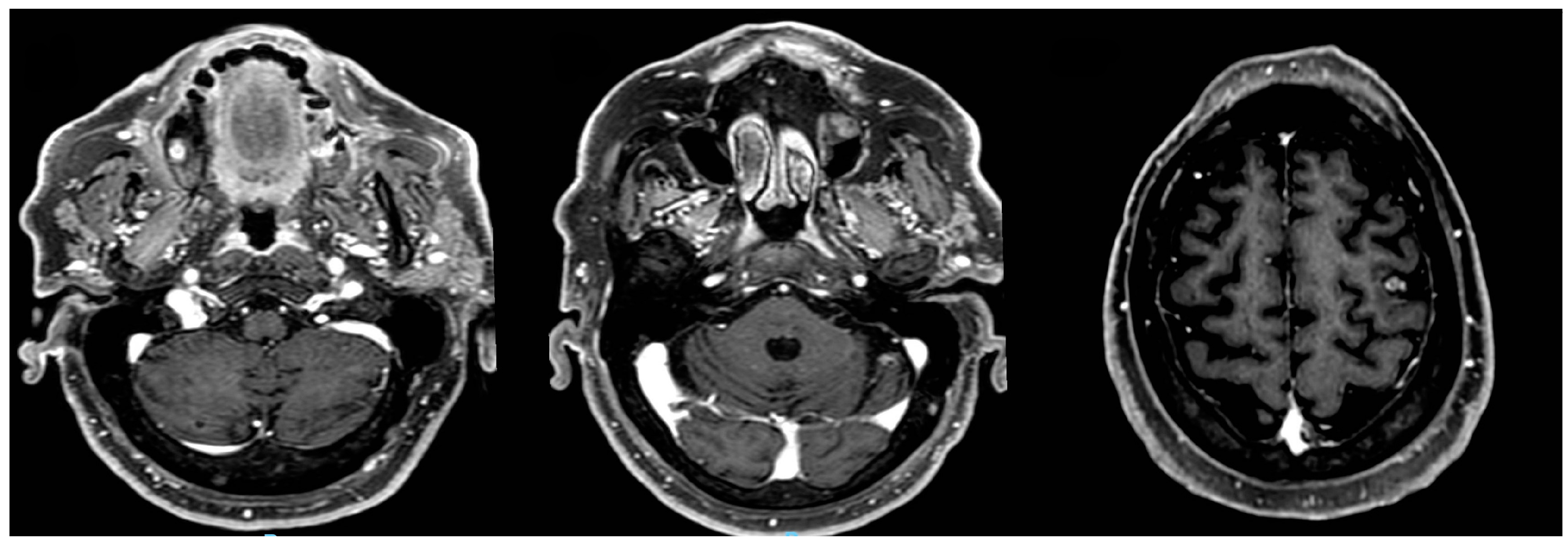 Preprints 139238 g005