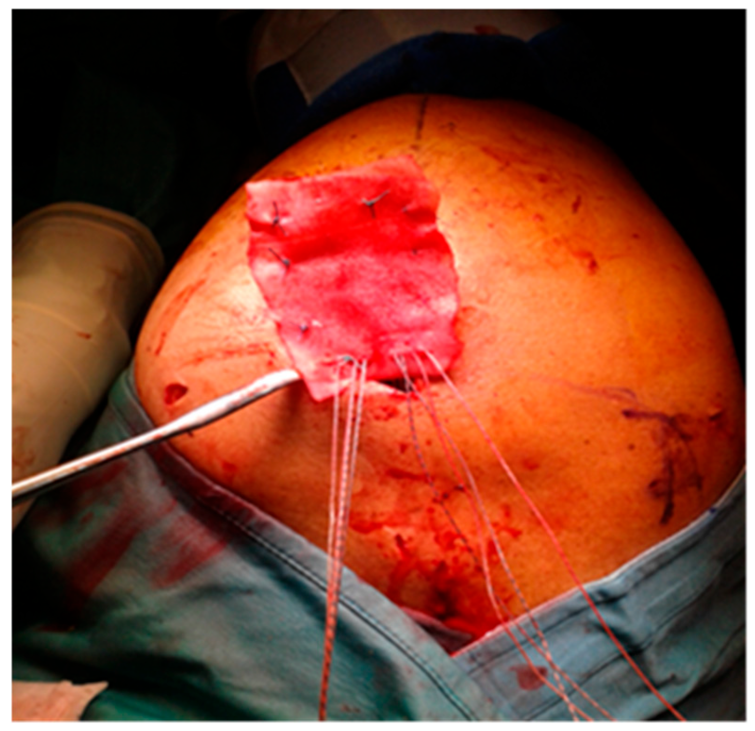 Preprints 116199 g001