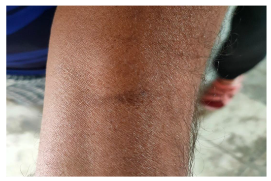 Preprints 154943 i032