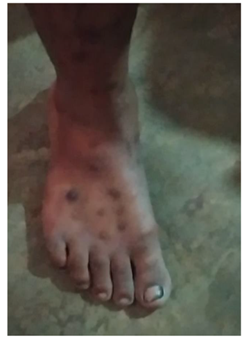 Preprints 154943 i033