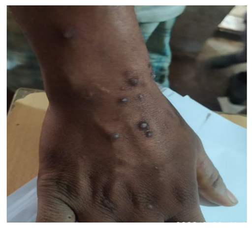 Preprints 154943 i034