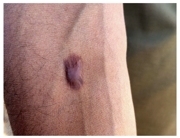 Preprints 154943 i035