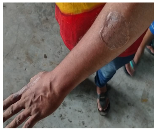 Preprints 154943 i036