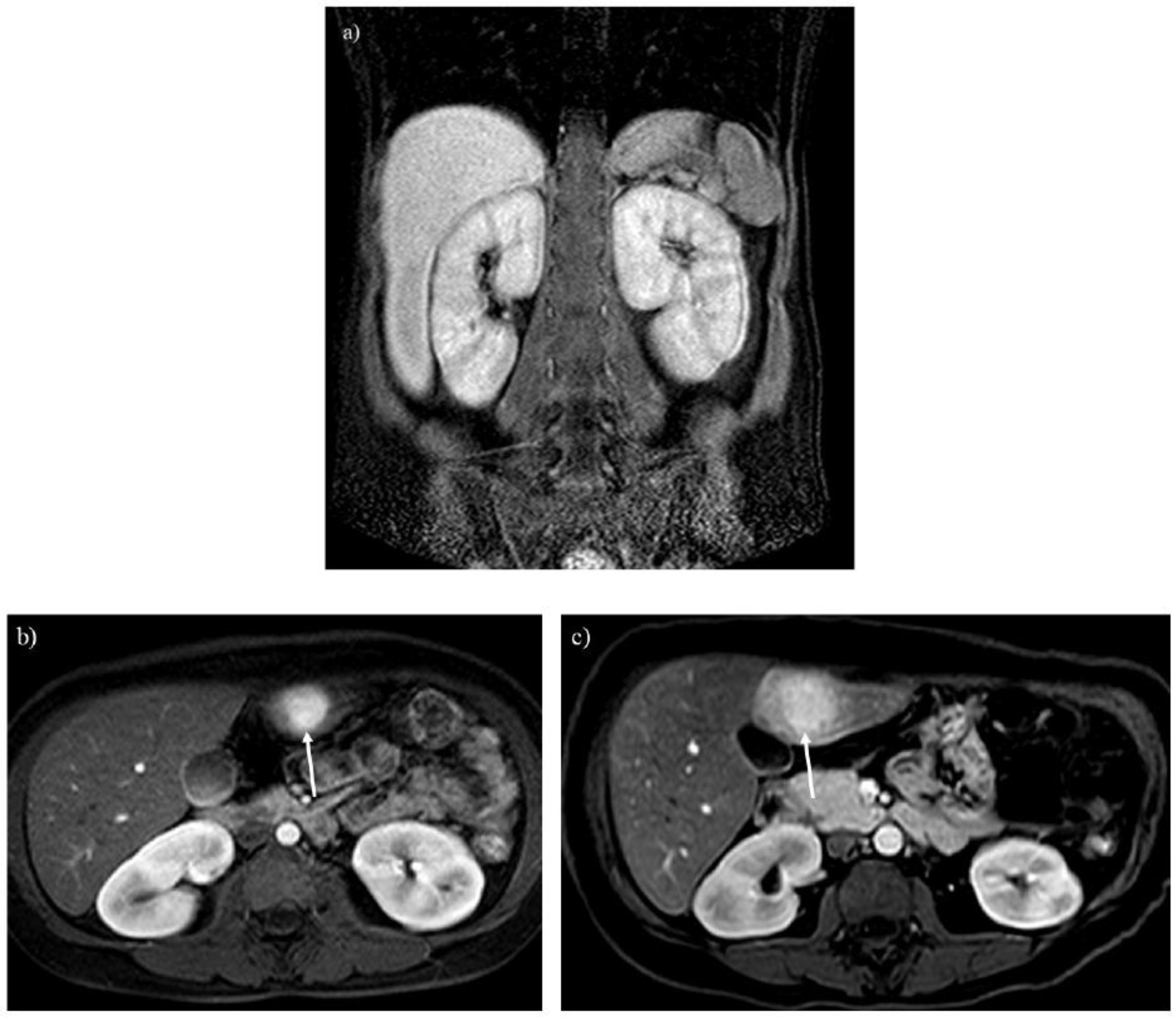 Preprints 147082 g003