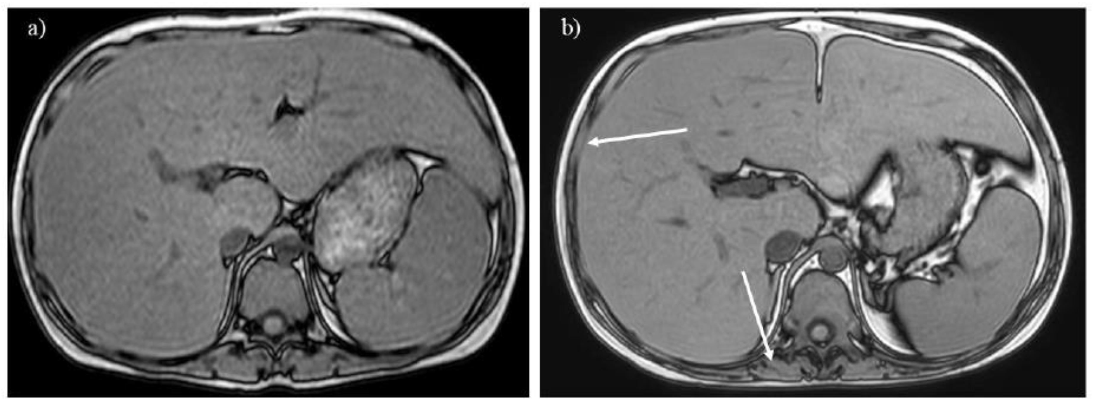 Preprints 147082 g006