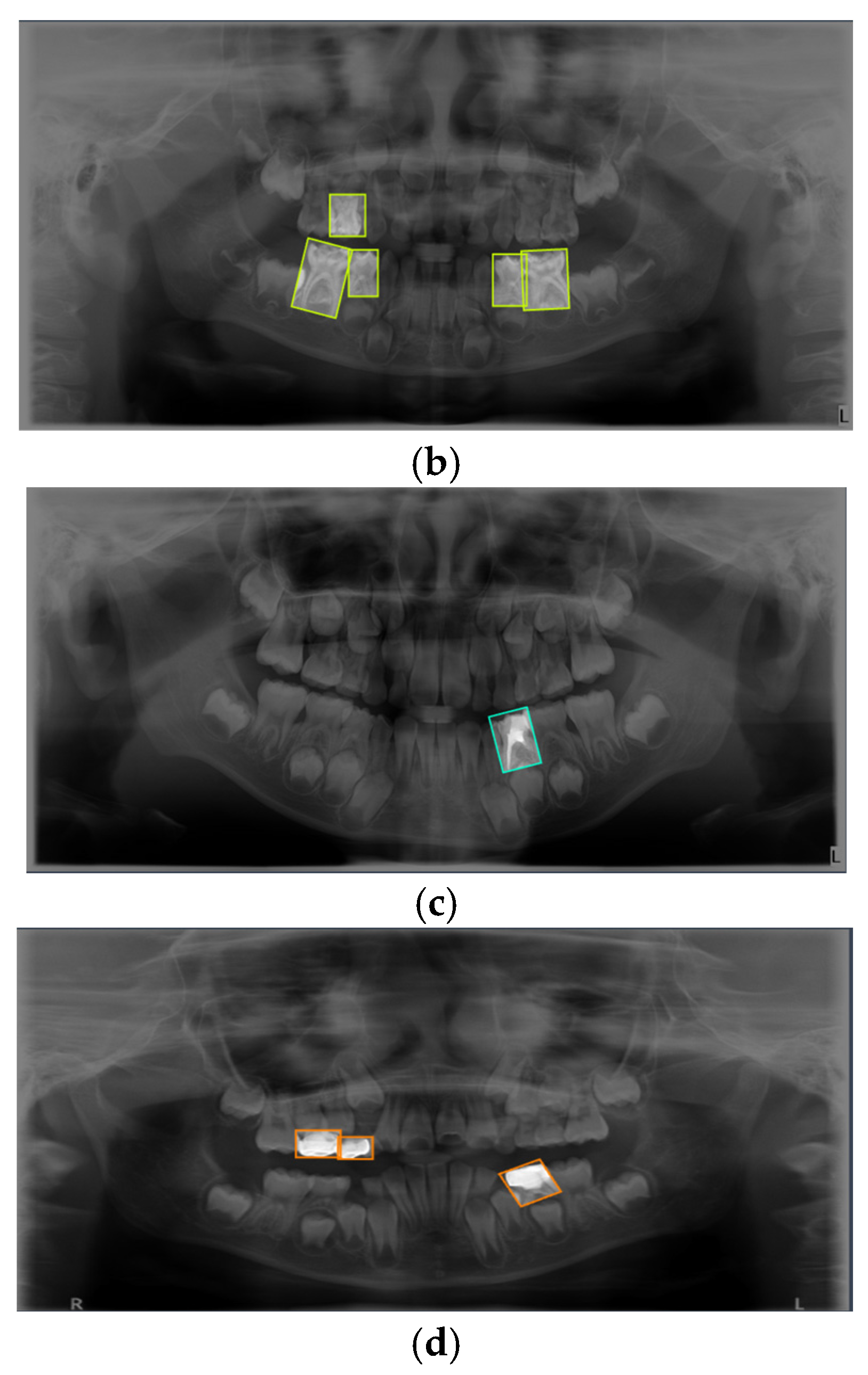Preprints 166188 g001b