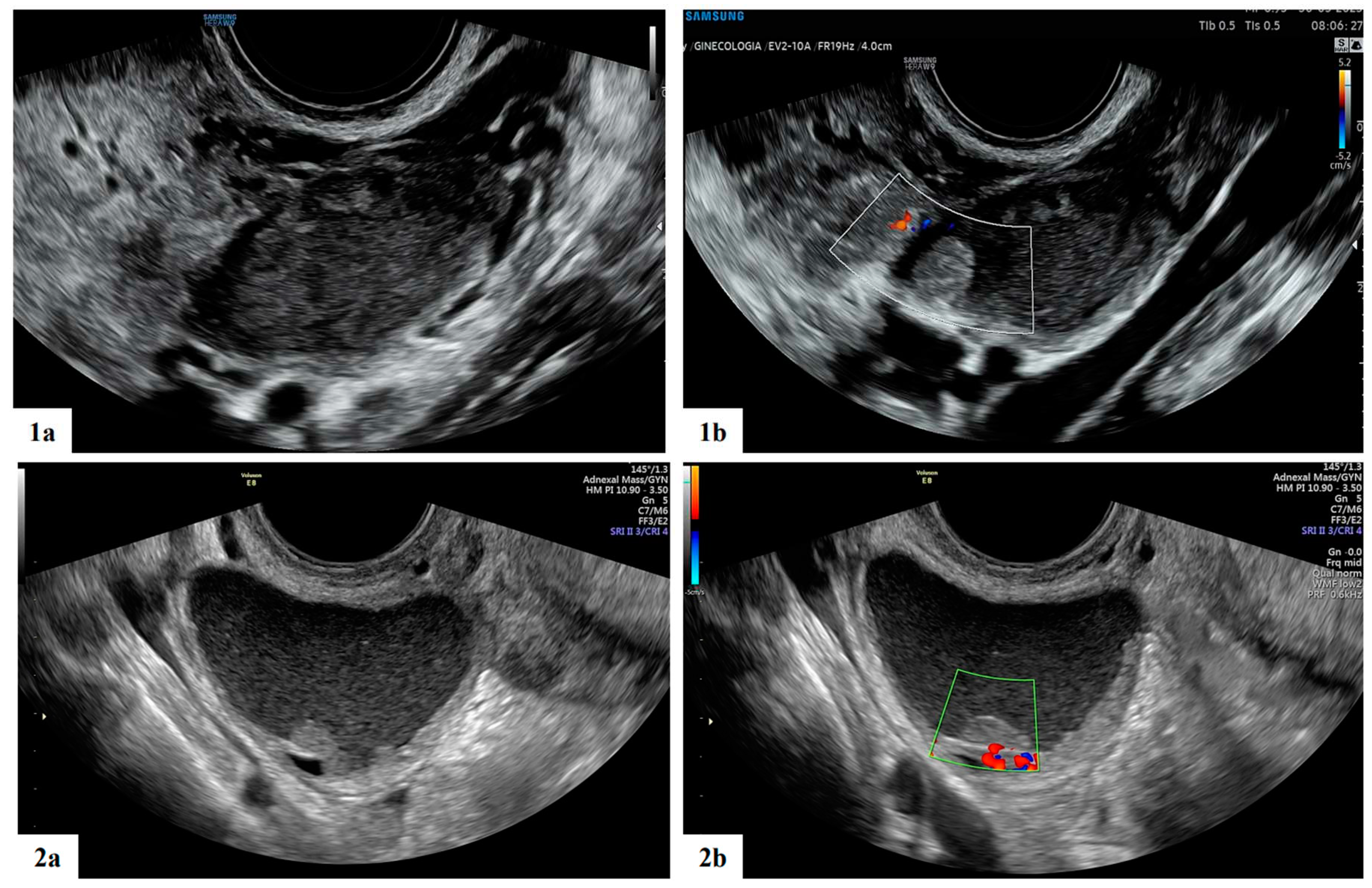 Preprints 84665 g004