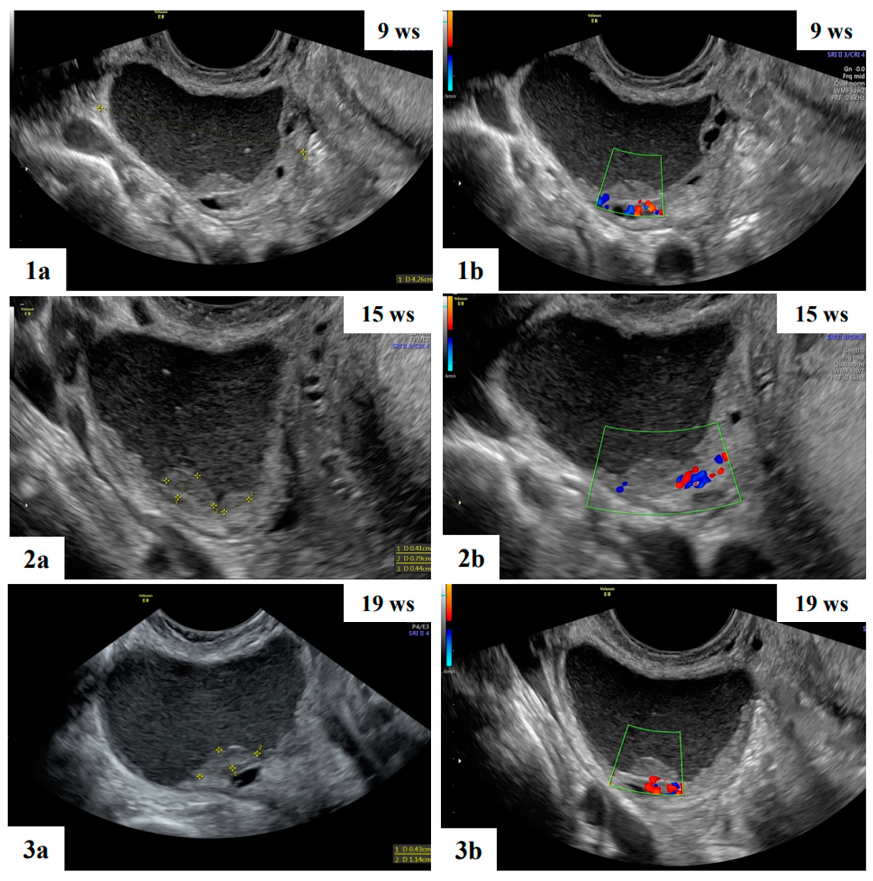 Preprints 84665 g005