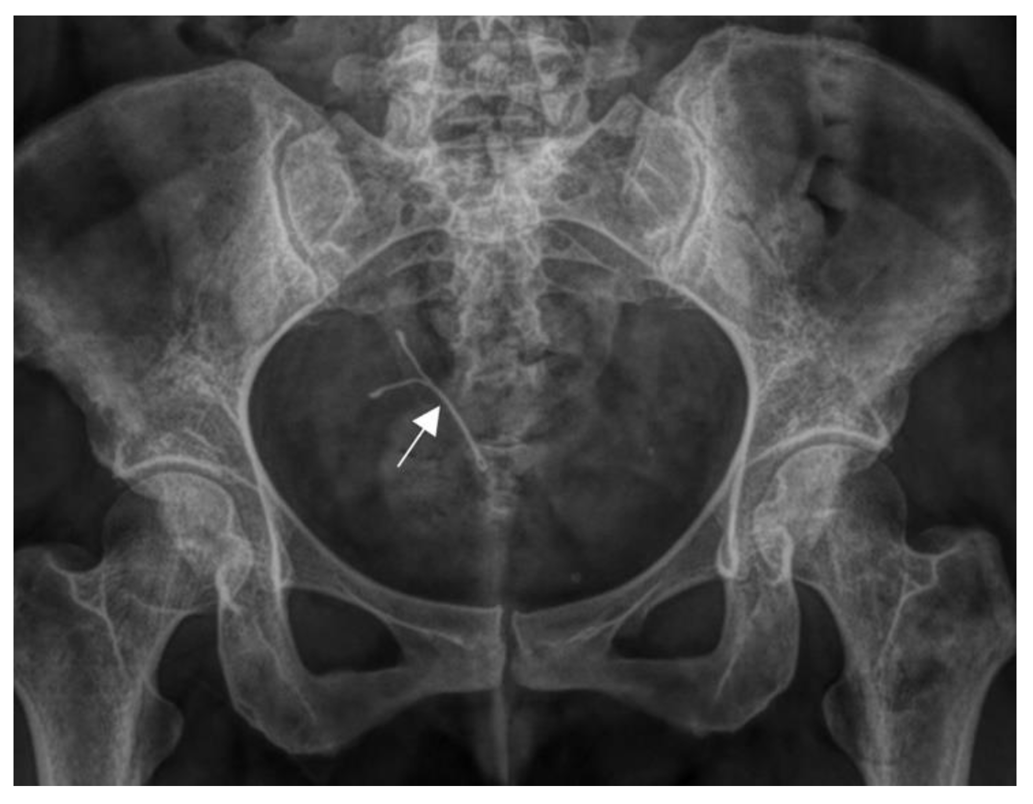 Preprints 180395 g003