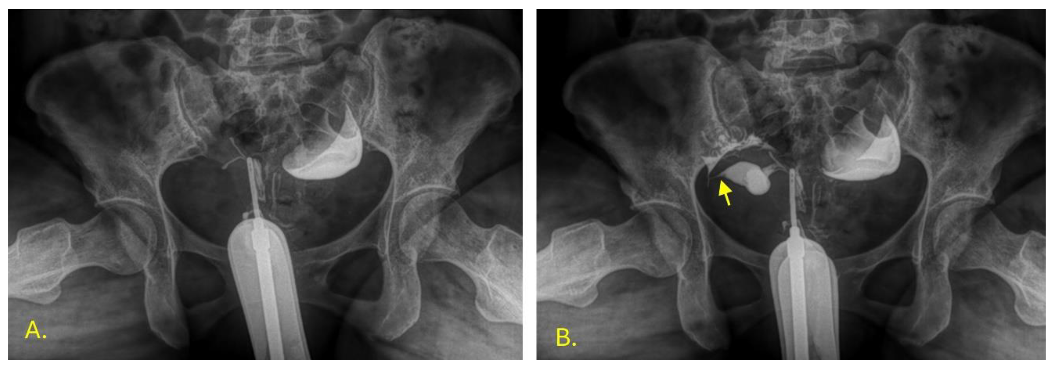 Preprints 180395 g005