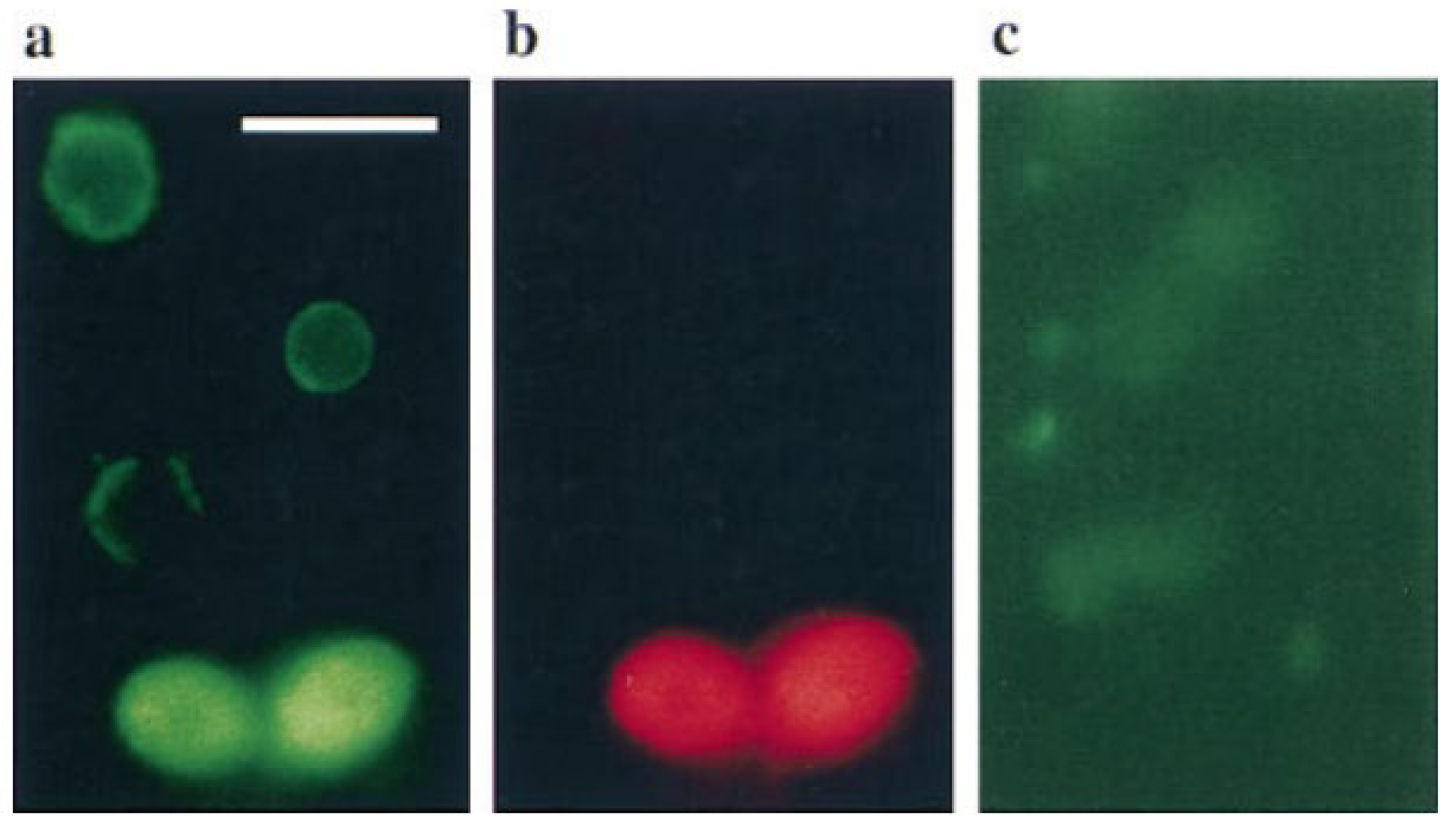 The Great Debate: Regulated Cell Death in Fungi and the Role of