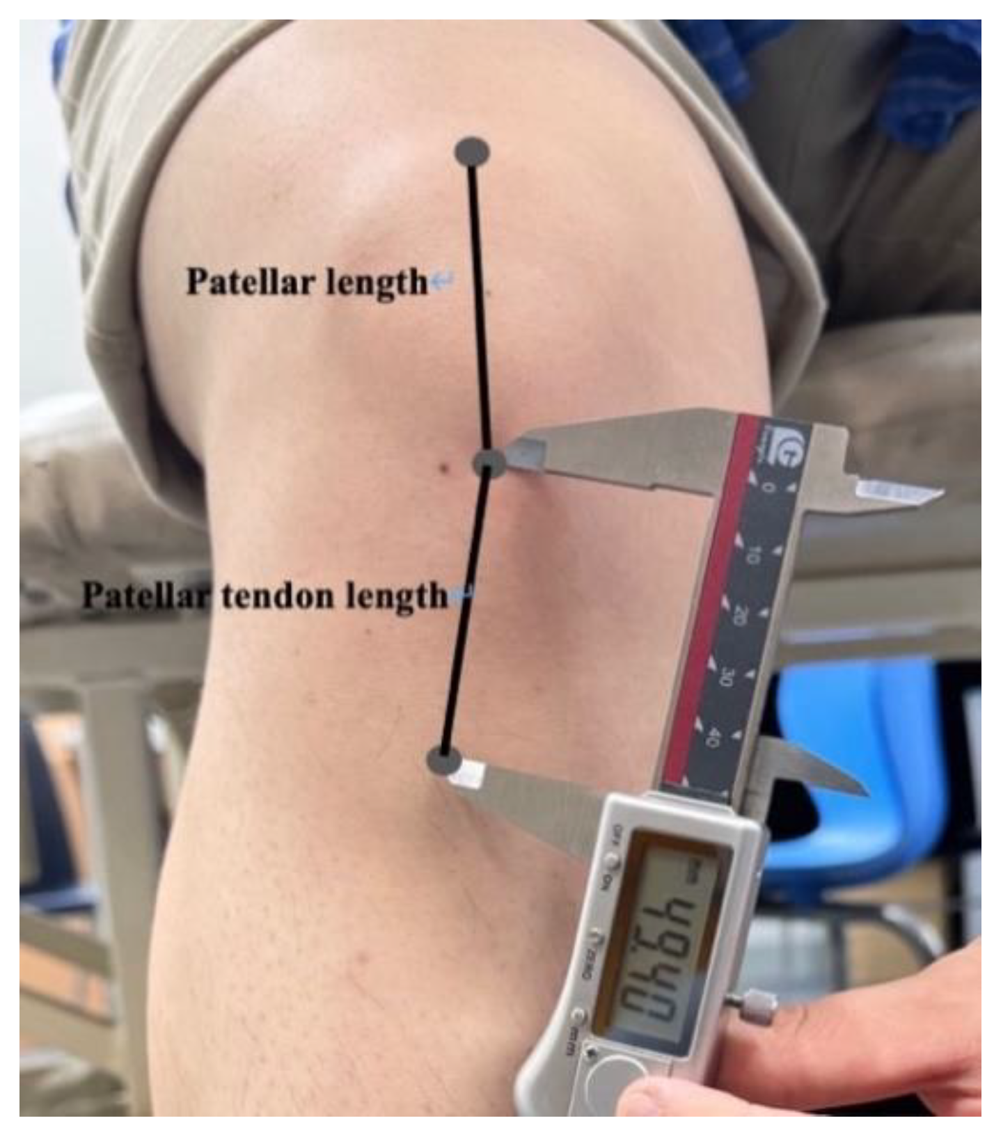 Preprints 141219 g001
