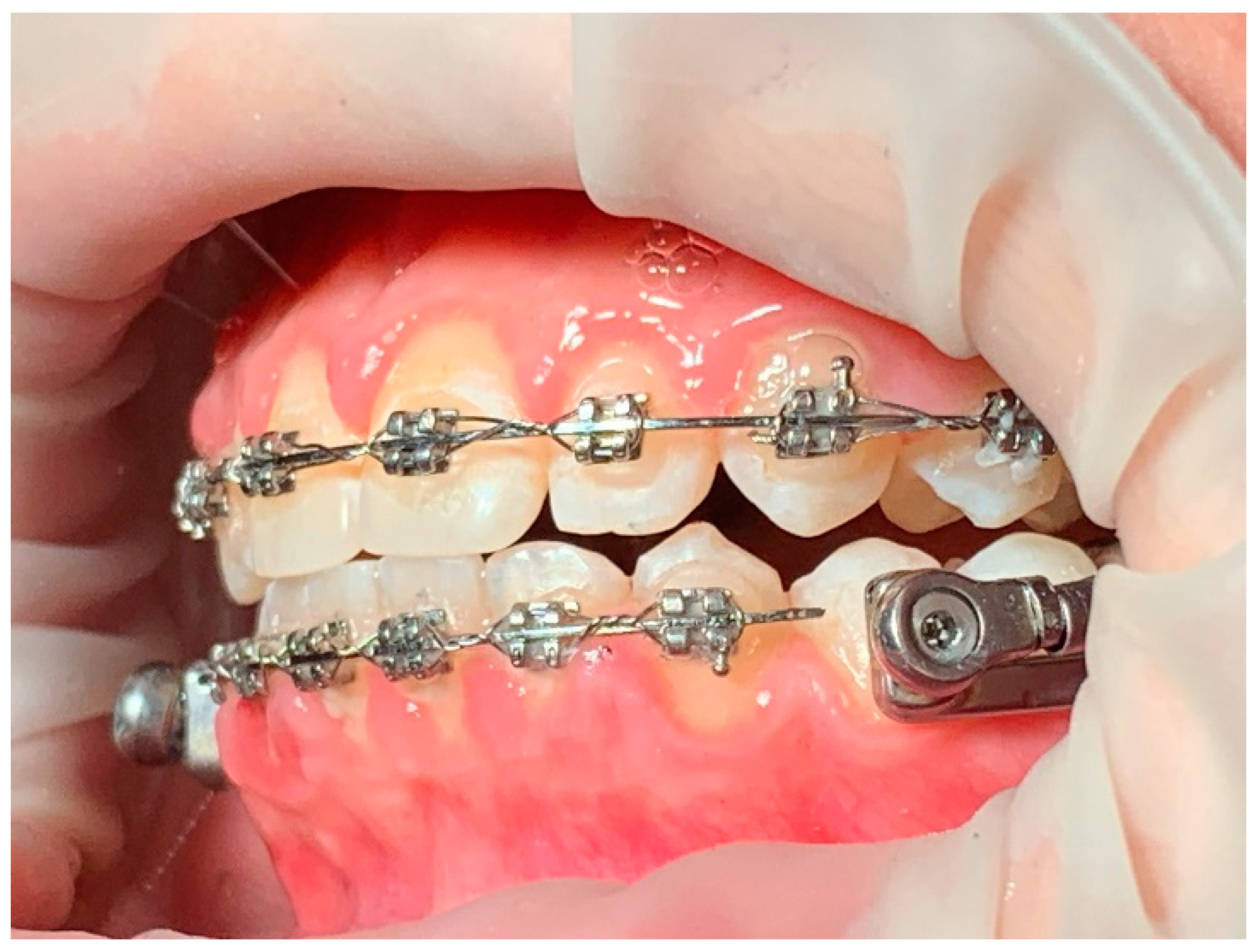 Preprints 147239 g003