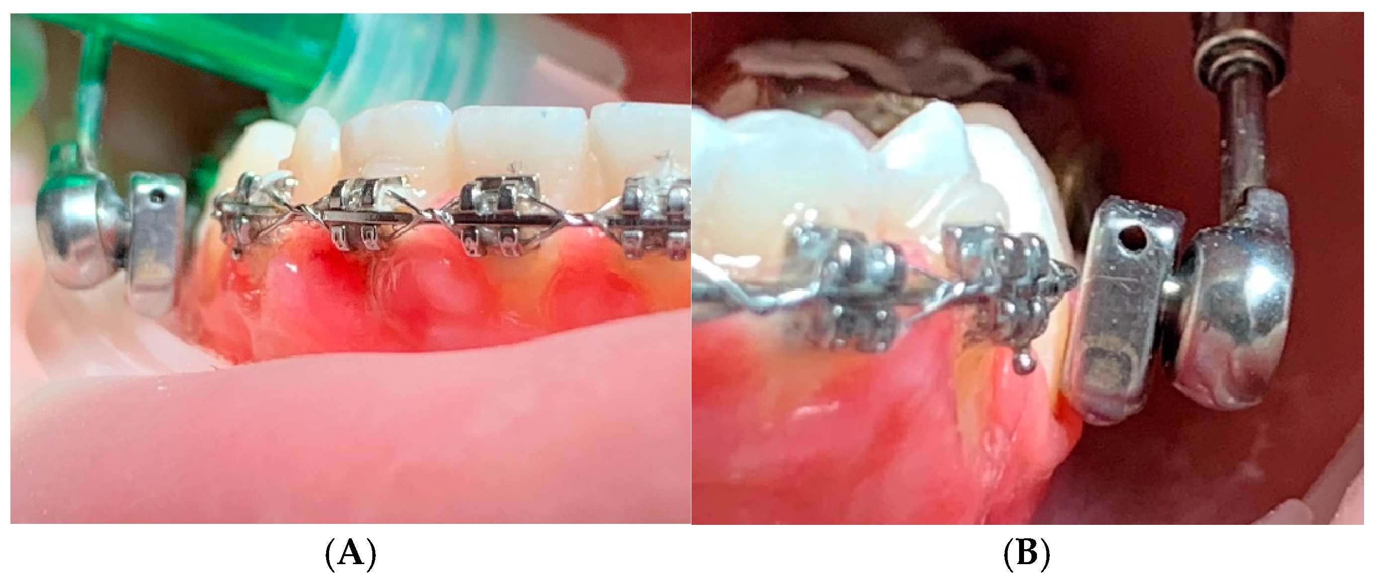 Preprints 147239 g006