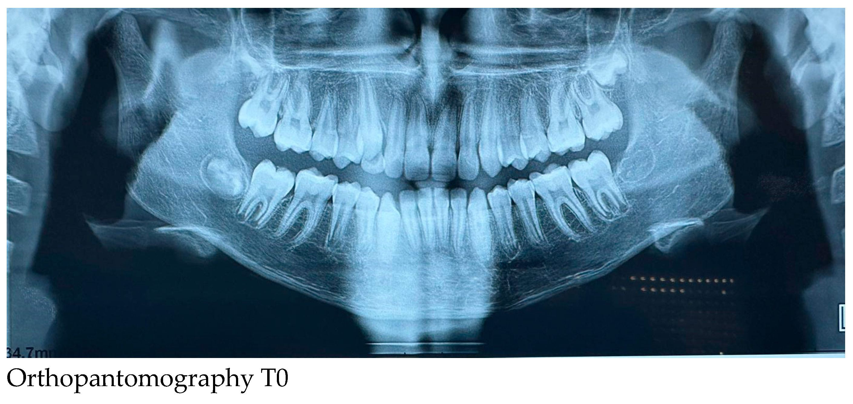 Preprints 147239 i001