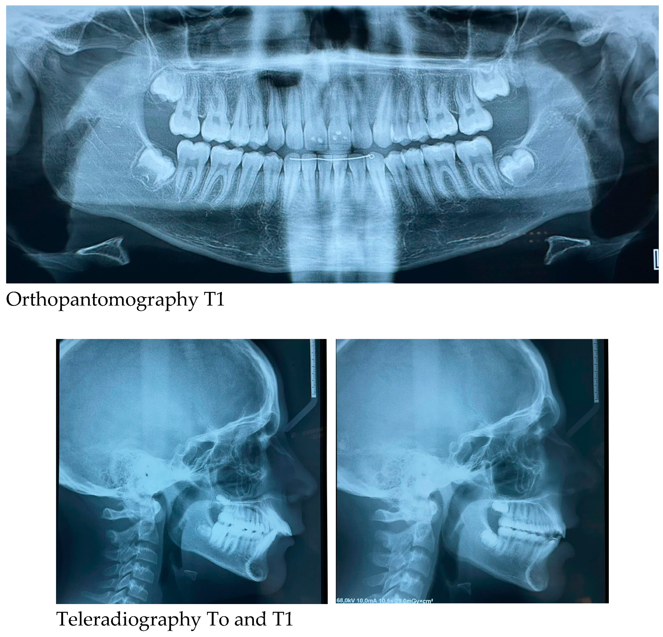 Preprints 147239 i002