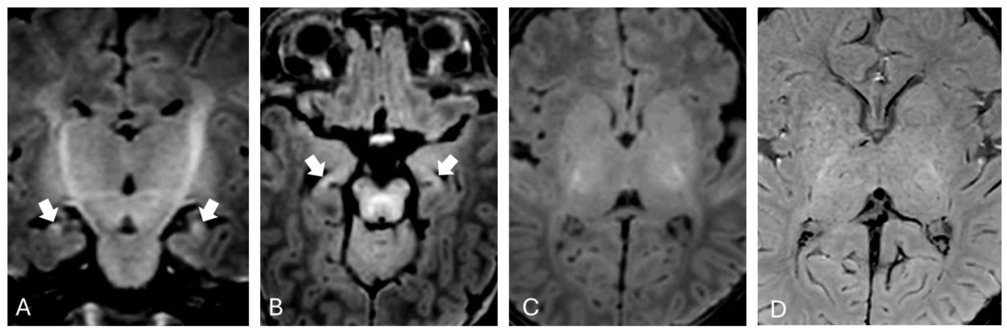 Preprints 156060 g001