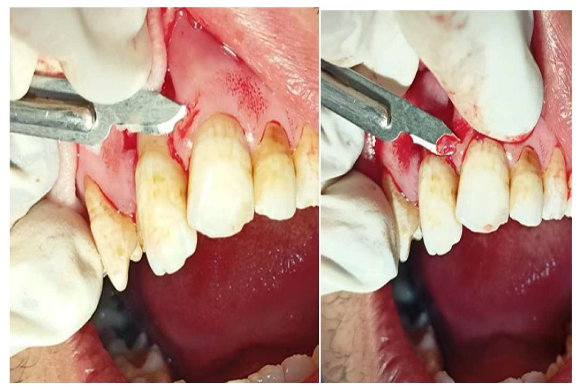 Preprints 139955 g023