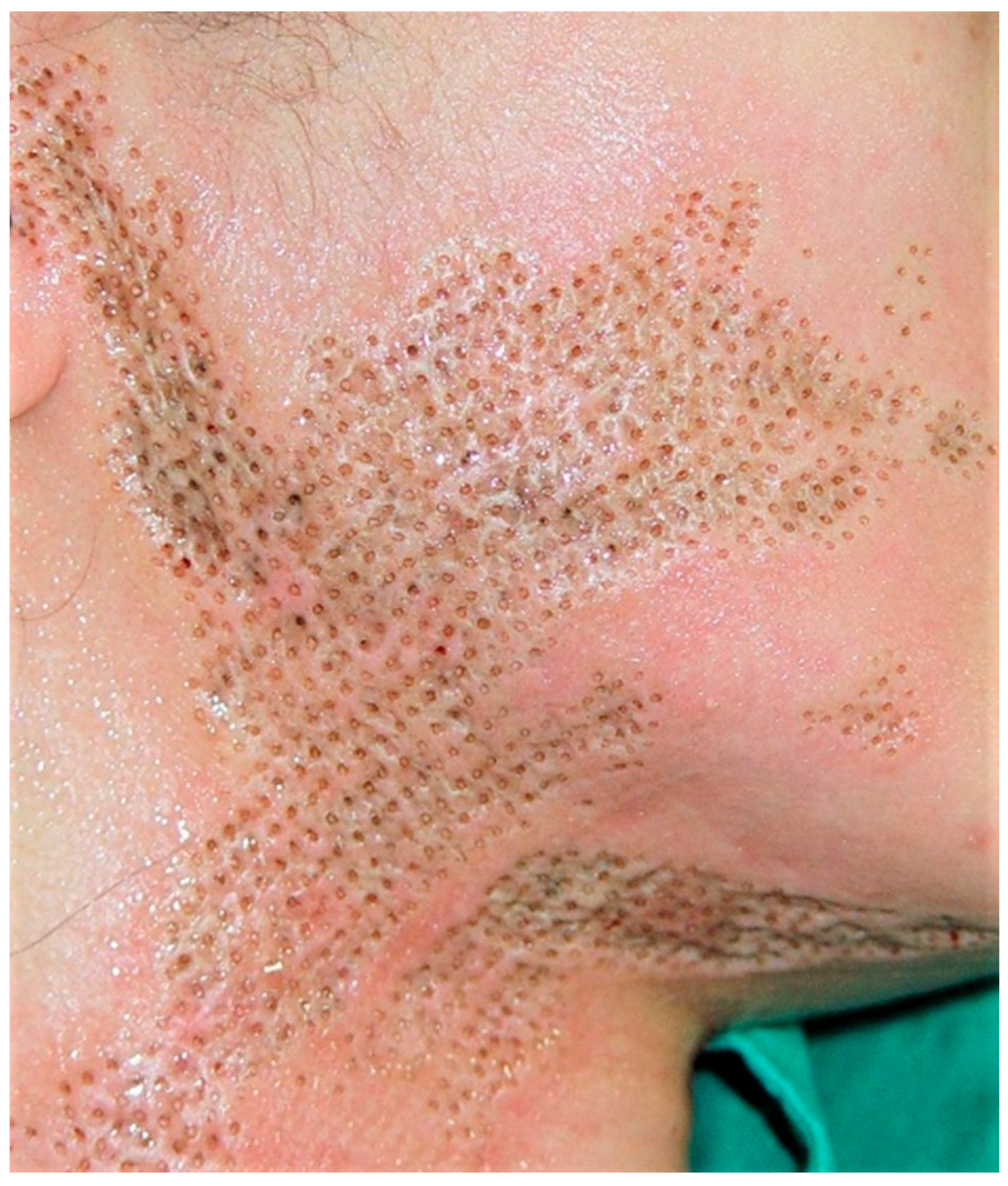 Preprints 171878 g002