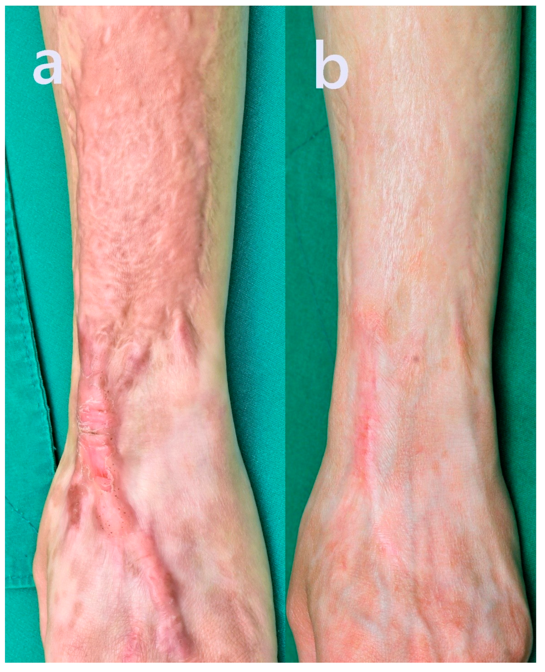 Preprints 171878 g004