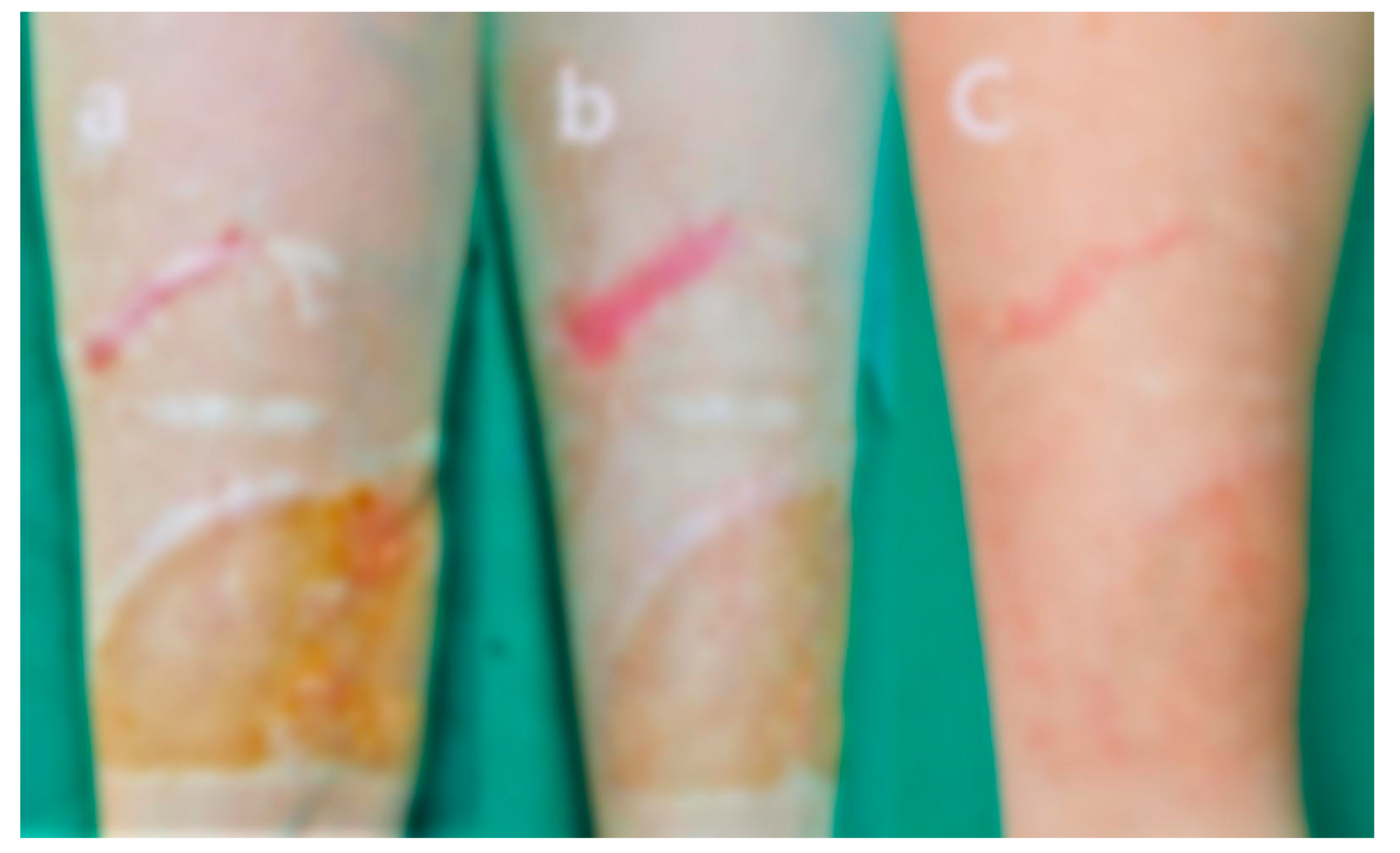 Preprints 171878 g006