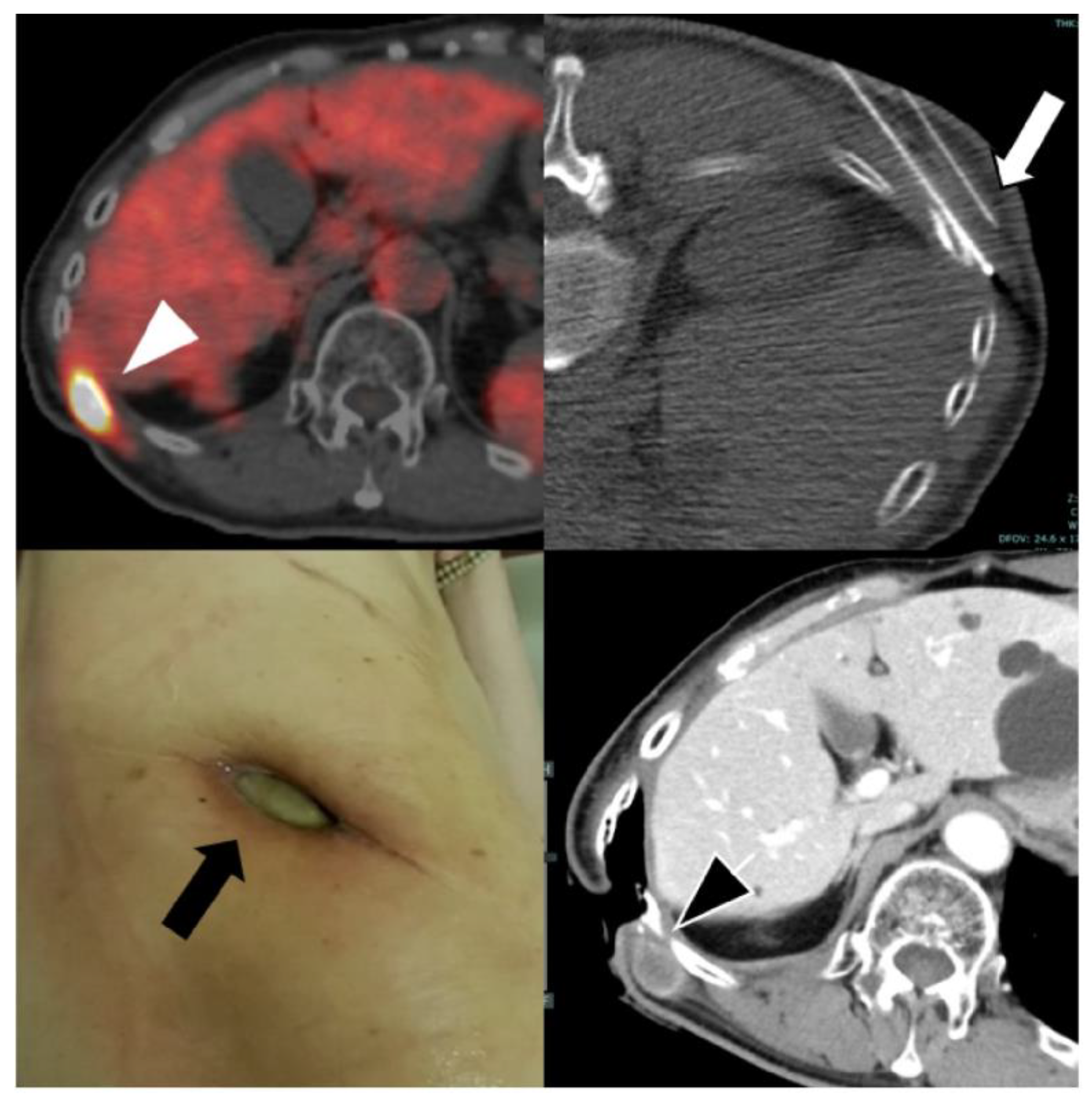 Preprints 188322 g005