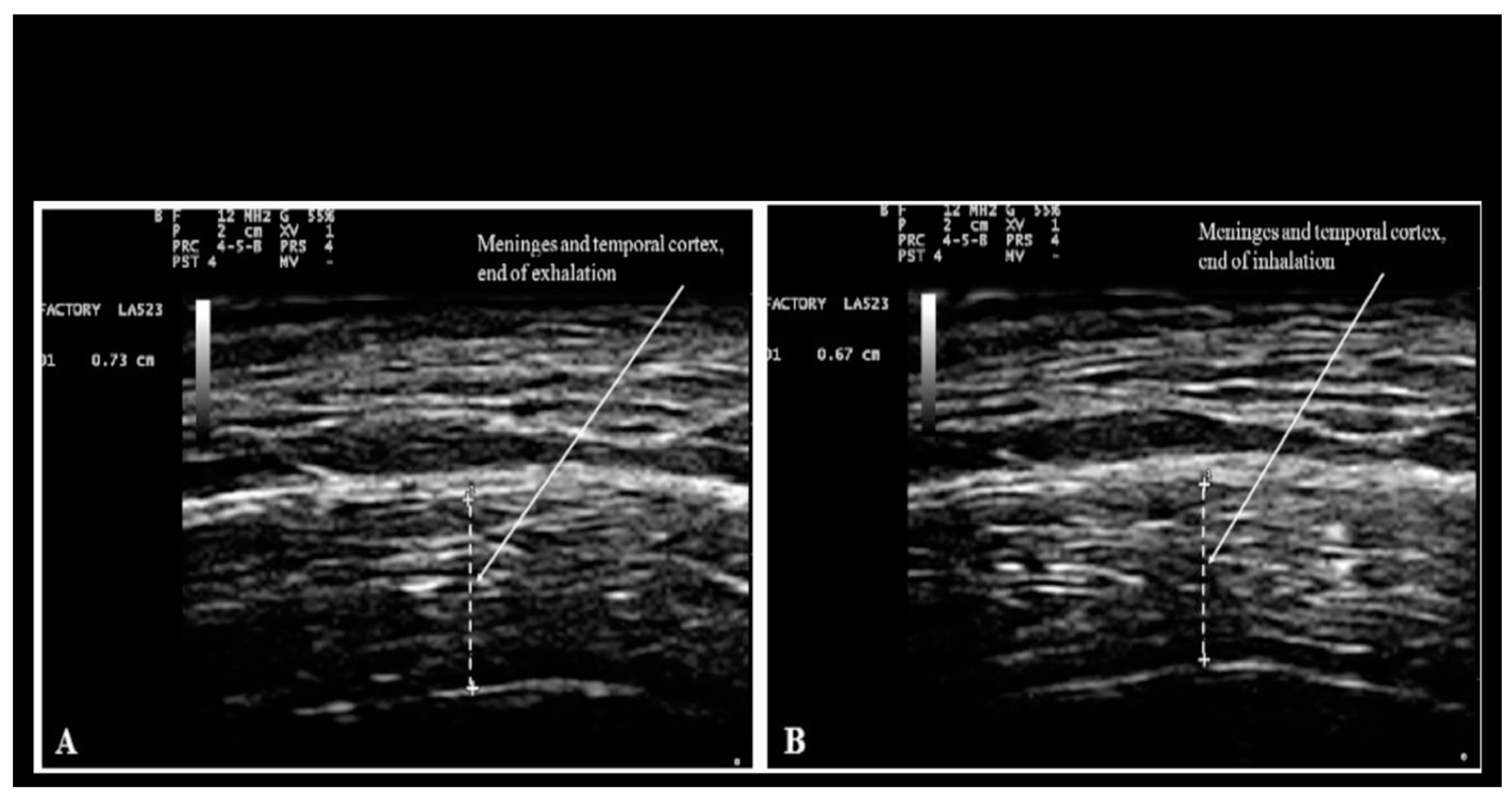 Preprints 110950 g001