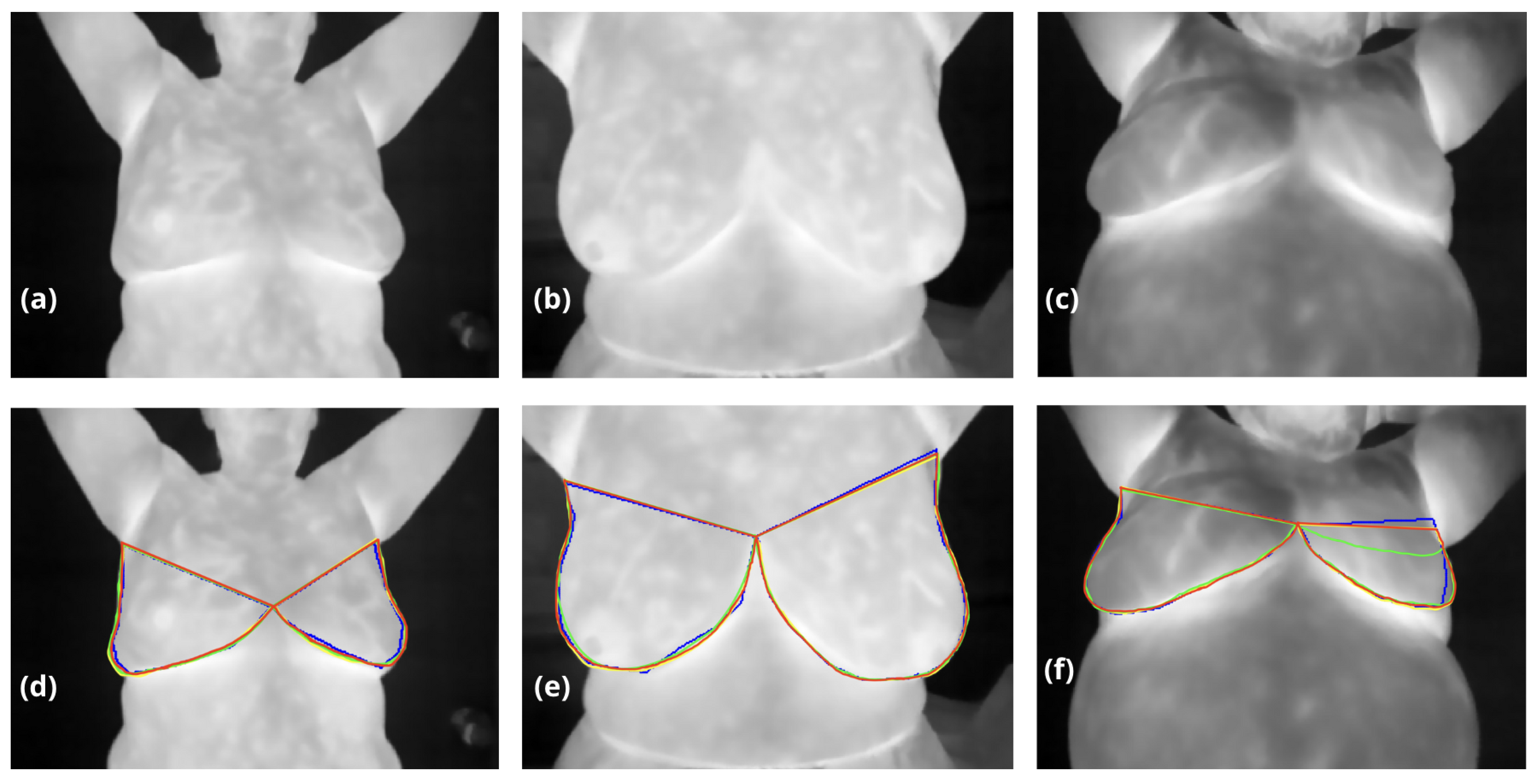Preprints 145385 g005