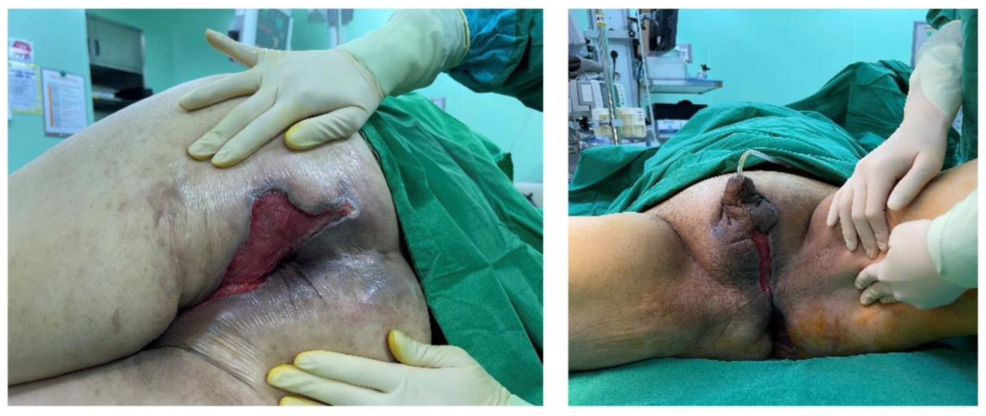 Preprints 184200 g003