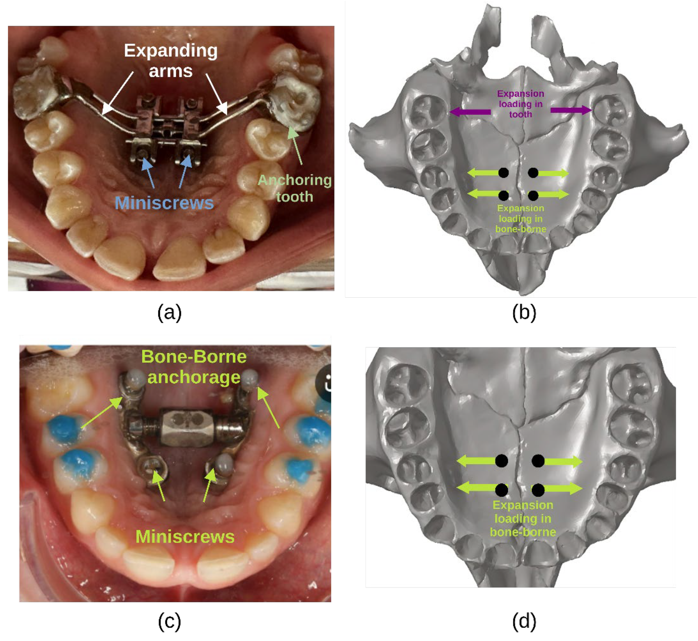 Preprints 170688 g004