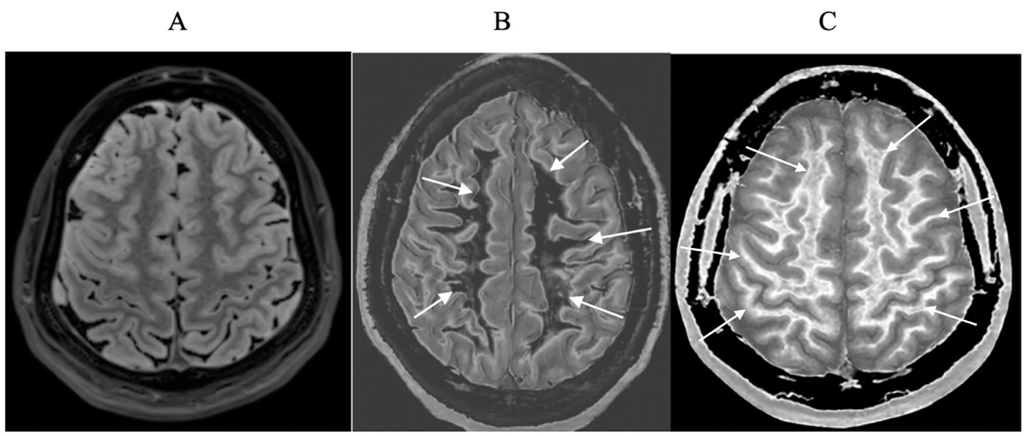 Preprints 161485 g001