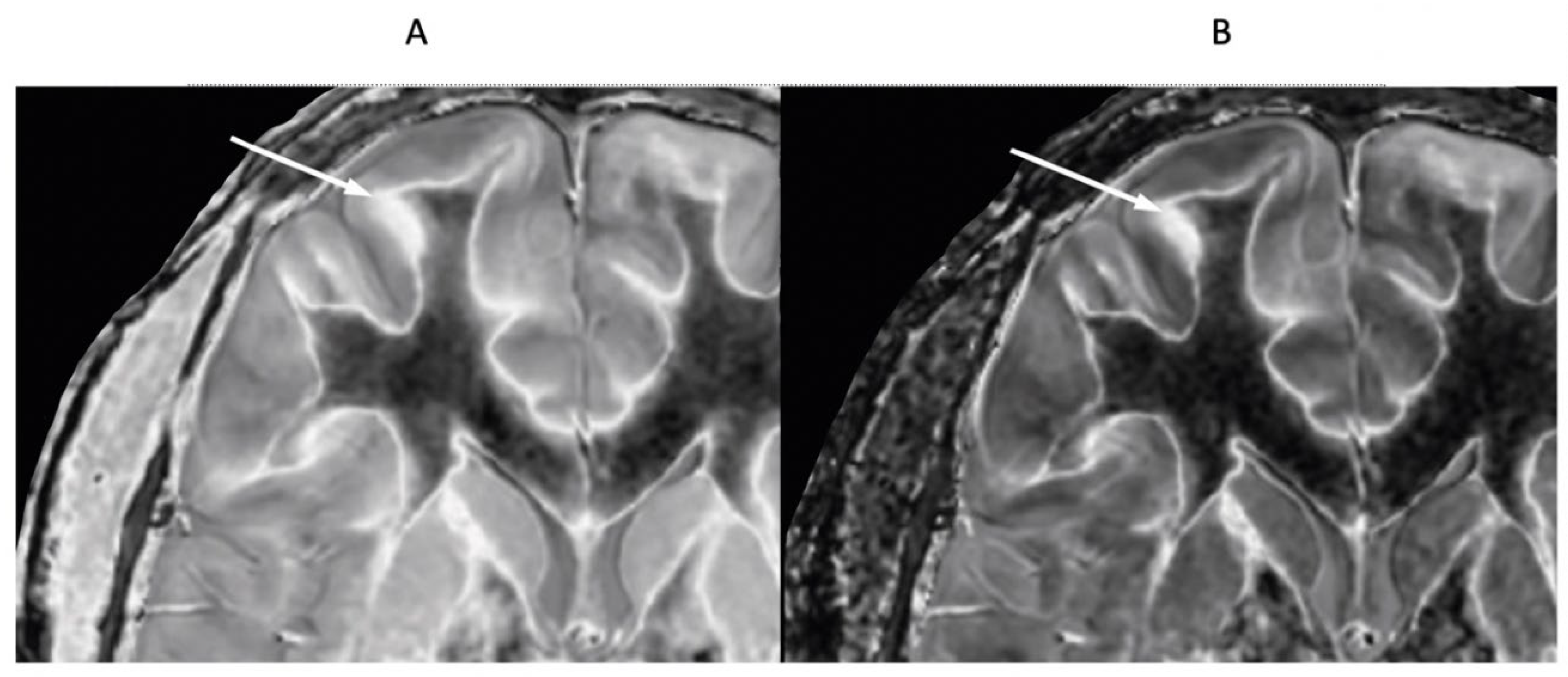 Preprints 161485 g017