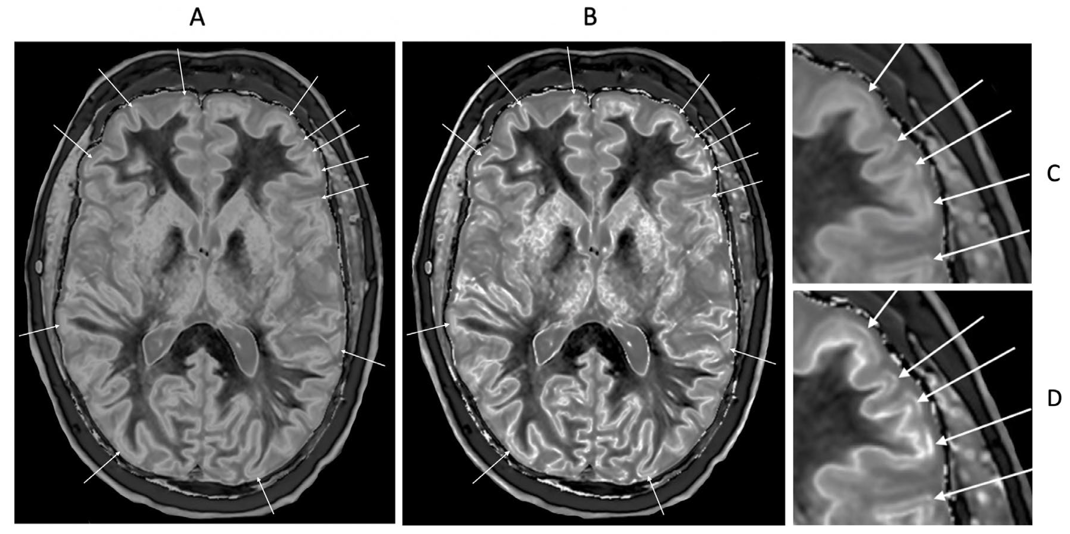 Preprints 161485 g022