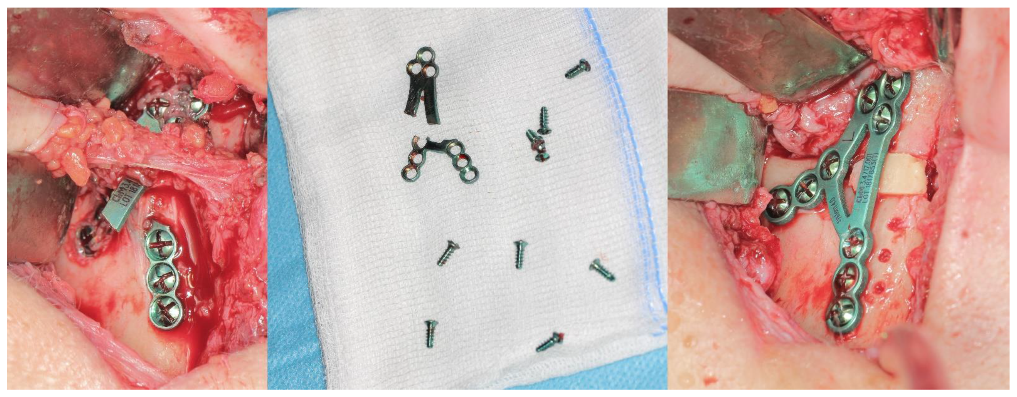 Preprints 175913 g004