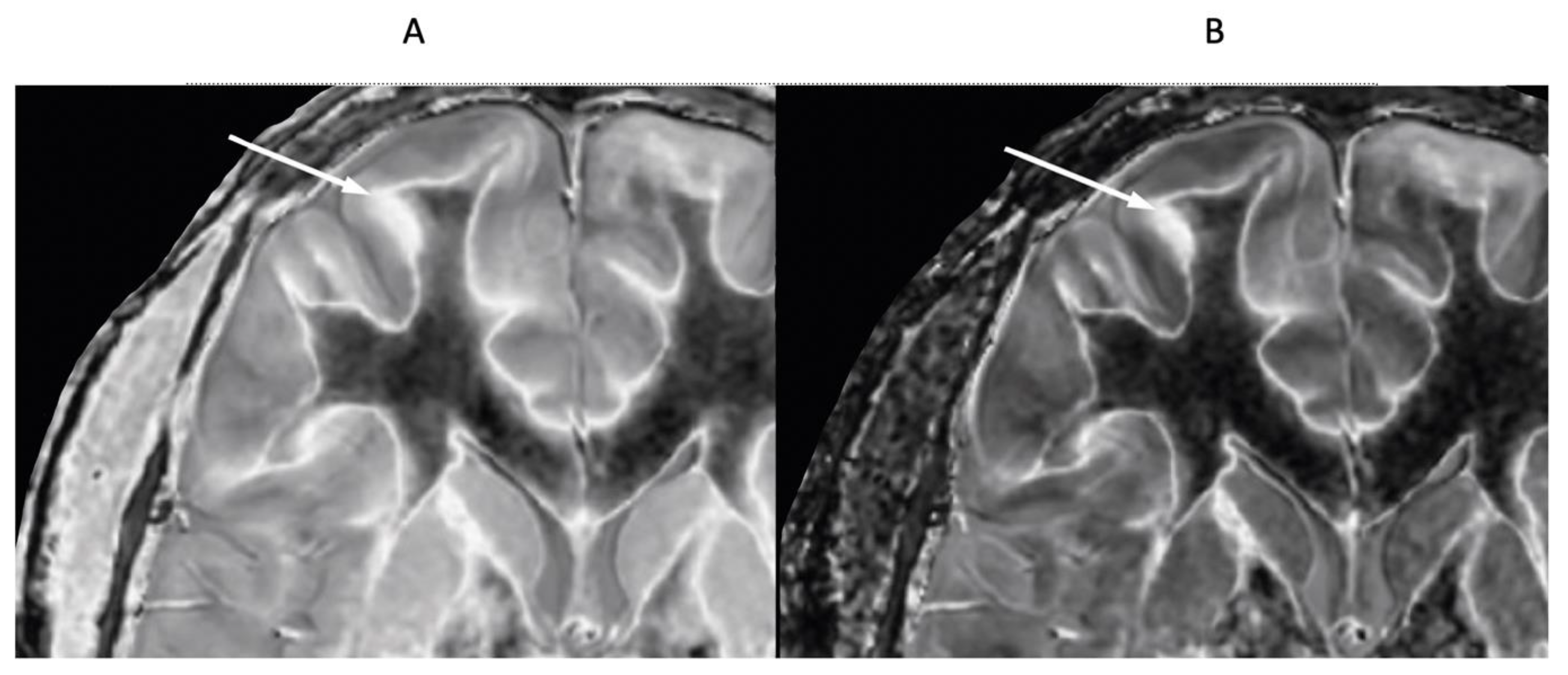Preprints 162094 g017