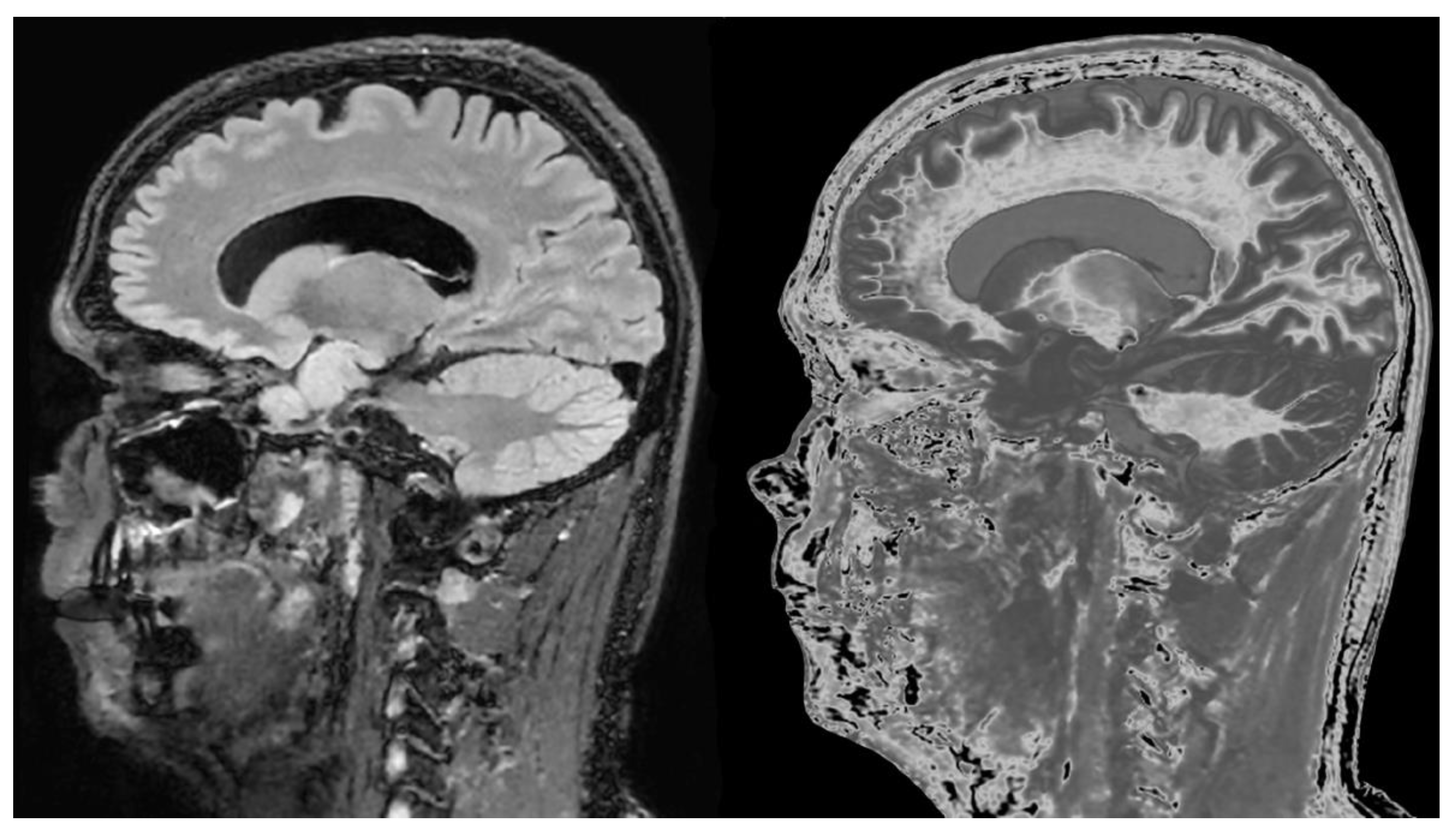 Preprints 162094 g021