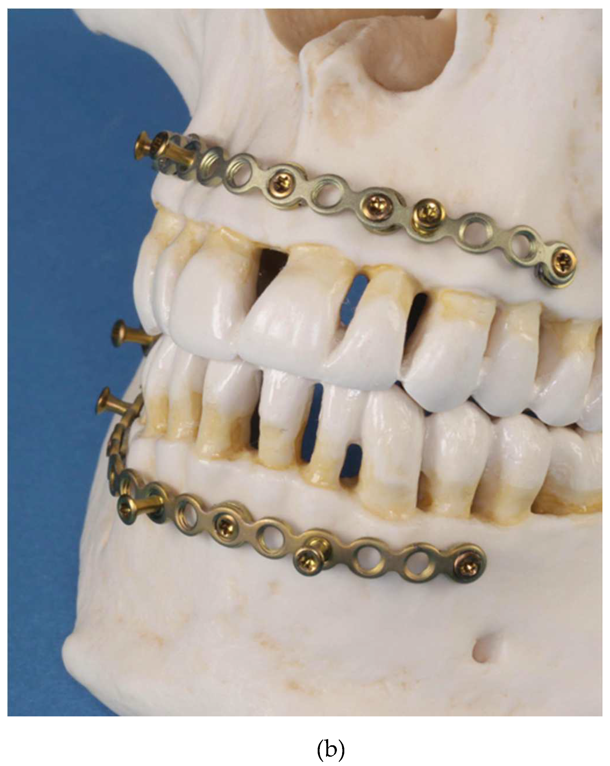 Preprints 150638 g002b