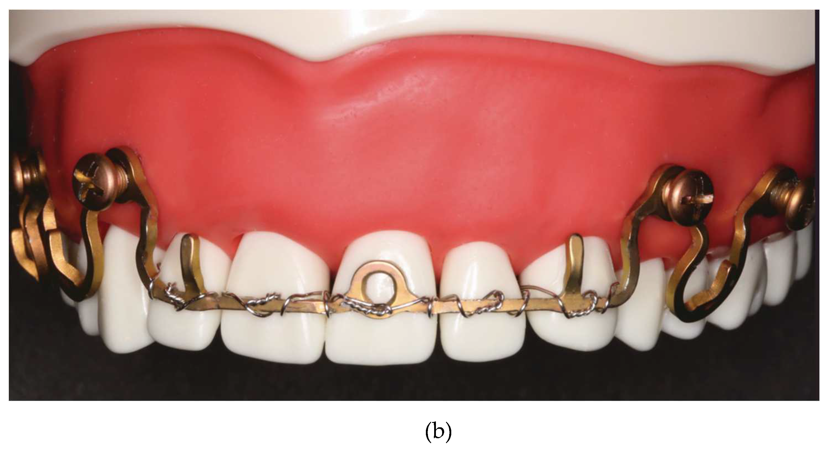 Preprints 150638 g014b