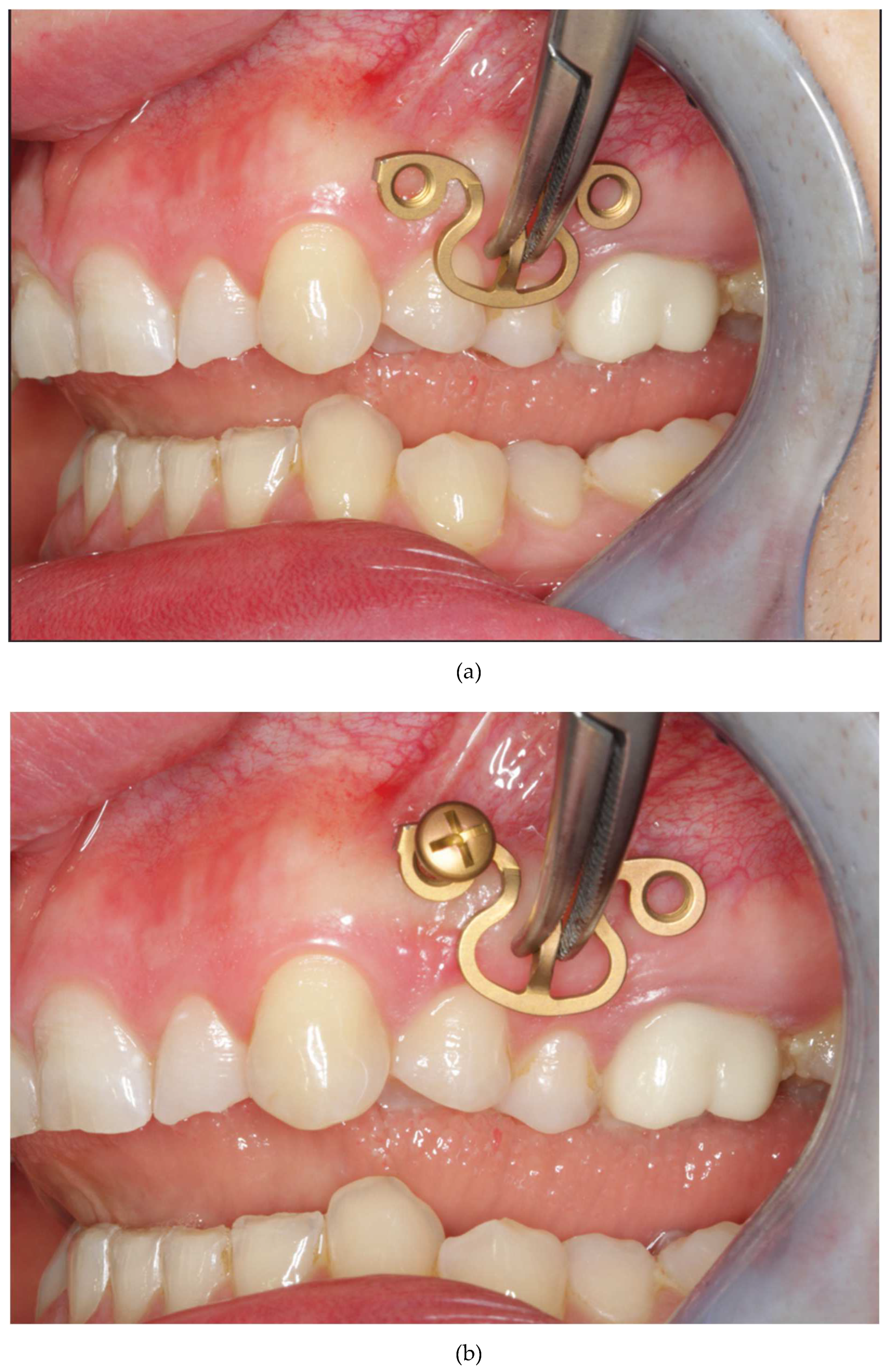 Preprints 150638 g015a