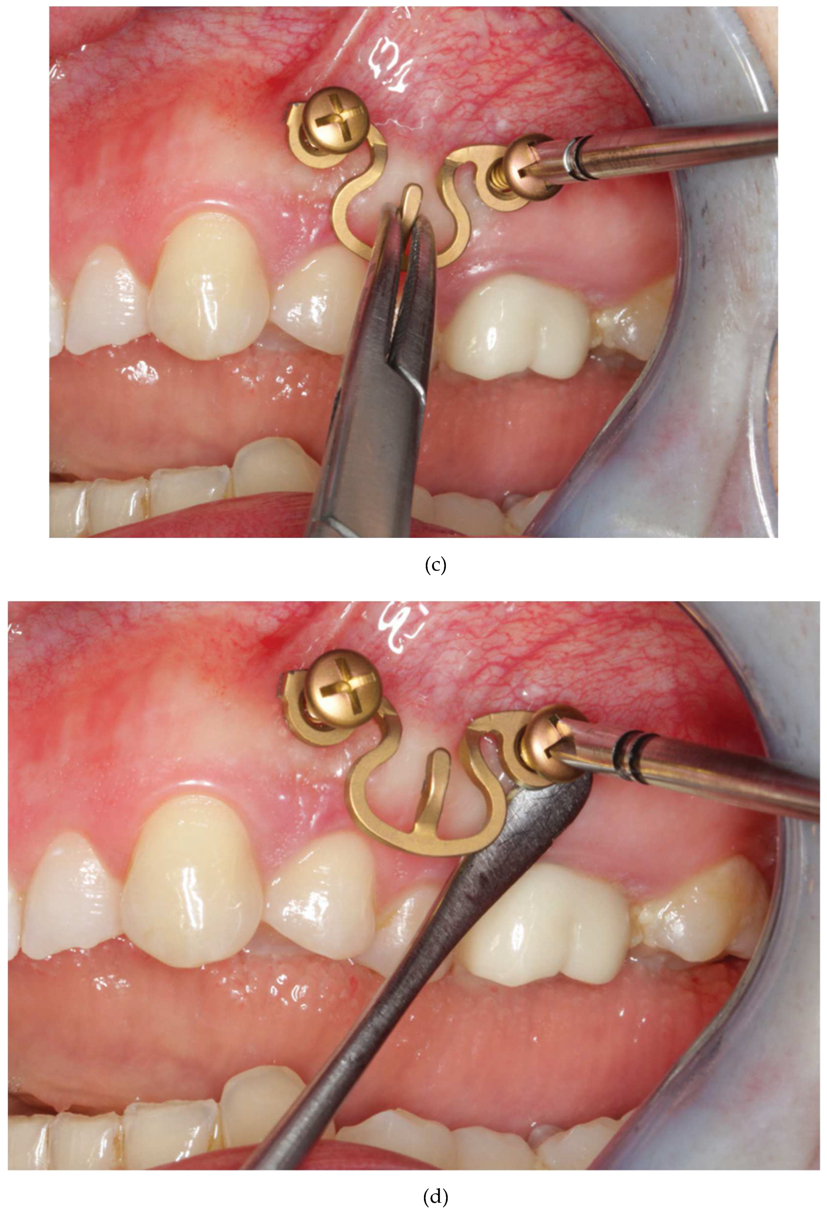 Preprints 150638 g015b