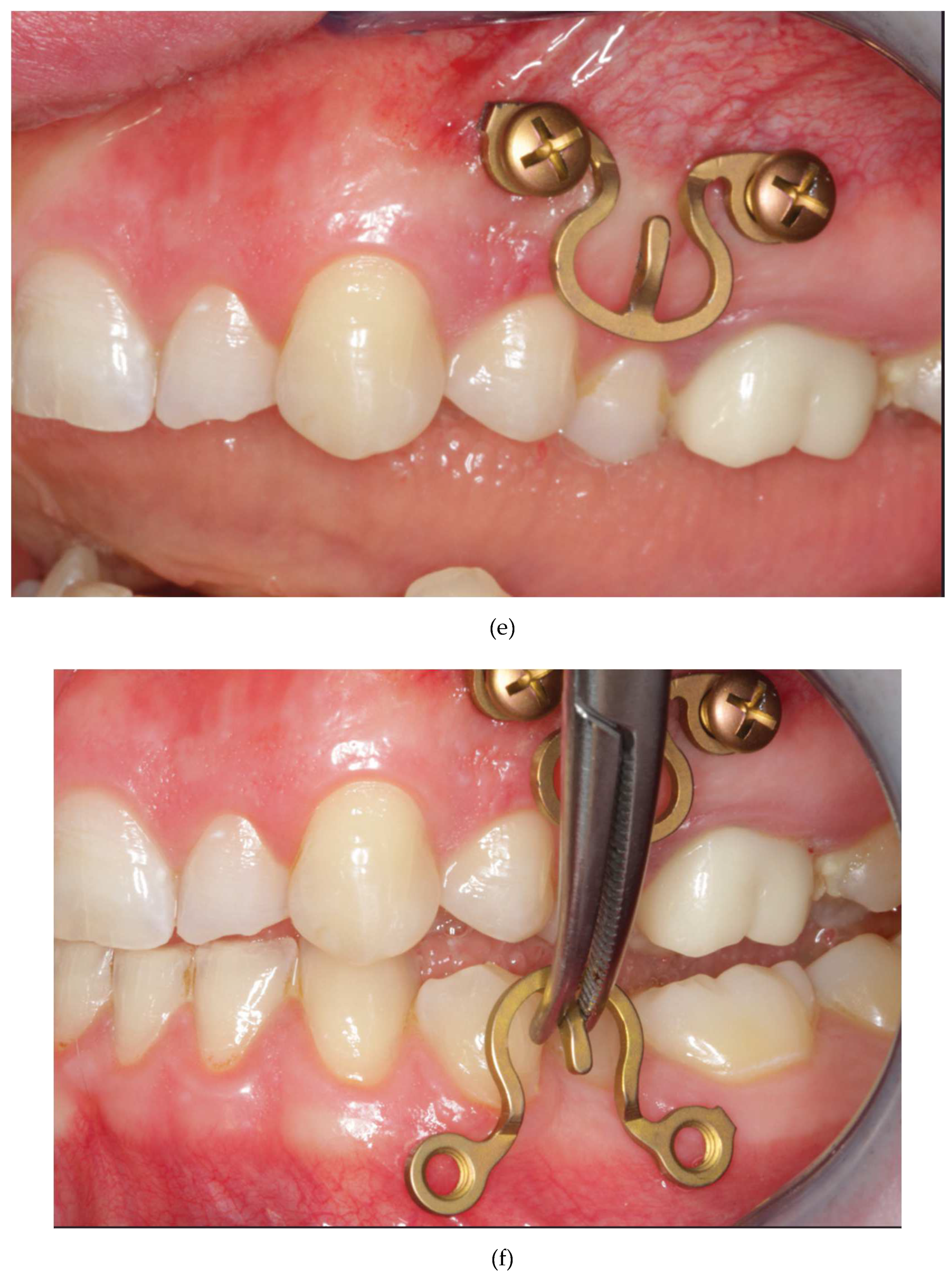 Preprints 150638 g015c